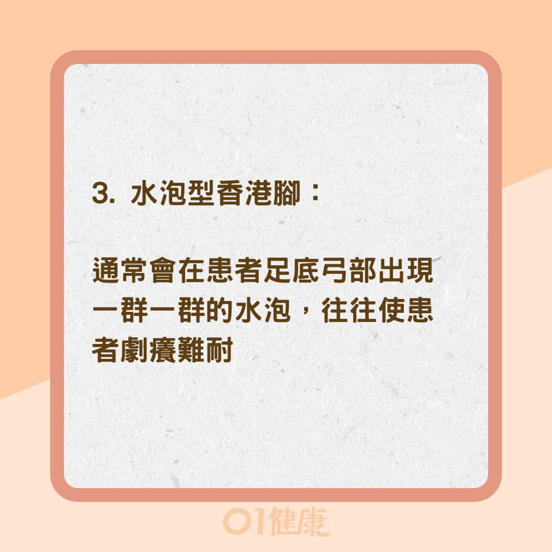 四種香港腳類型和症狀(01製圖) 四種香港腳類型和症狀(01製圖)