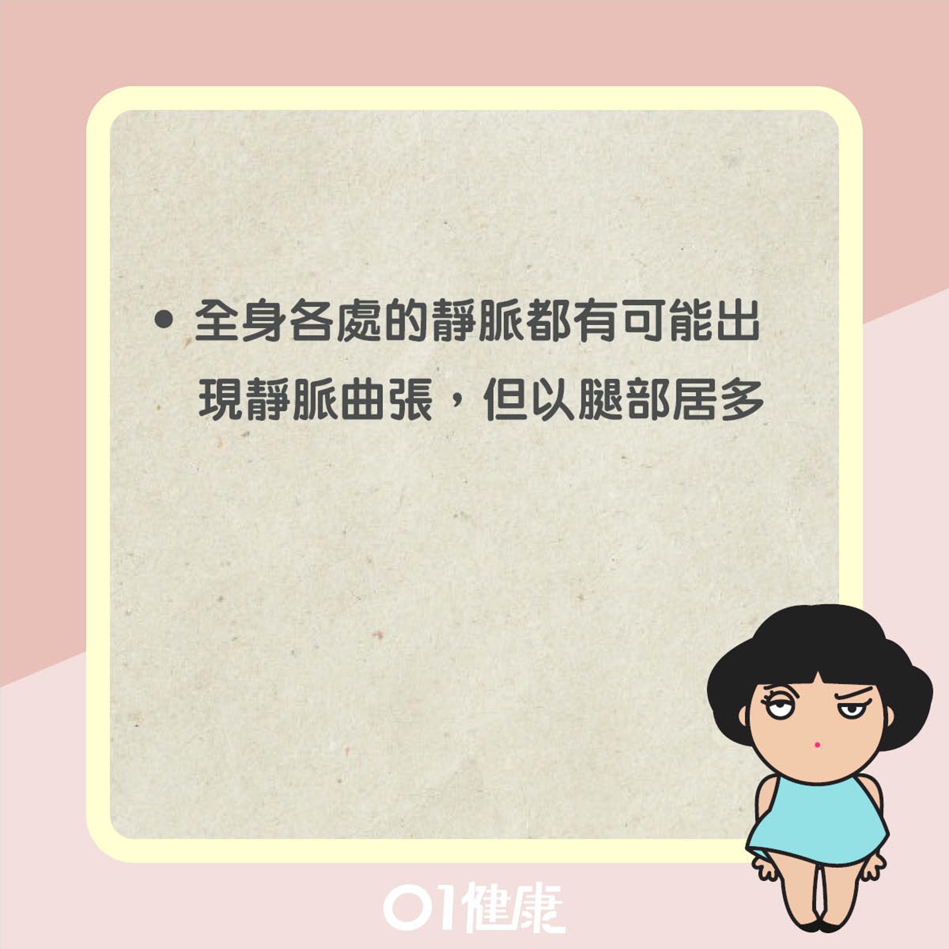靜脈曲張知多啲(01製圖) 靜脈曲張知多啲(01製圖)