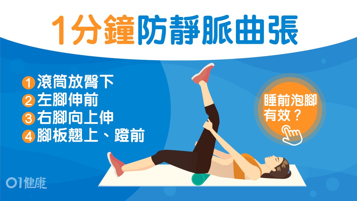 靜脈曲張 血管突半夜腳抽筋6症狀可致肺栓塞伸展3招暢通腳血流 香港01 健康
