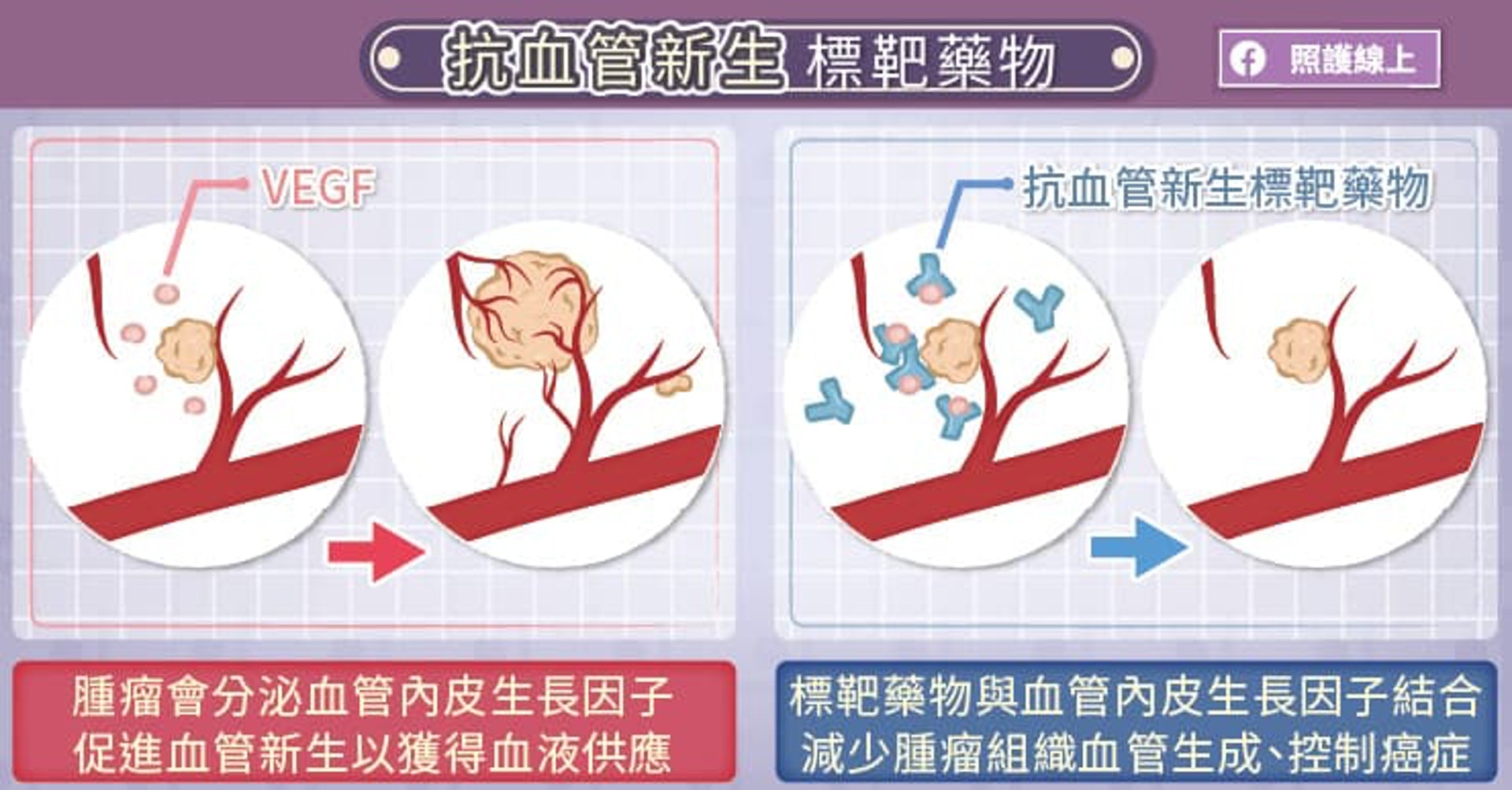 抗血管新生標靶藥物(照護線上授權使用) 抗血管新生標靶藥物(照護線上授權使用)