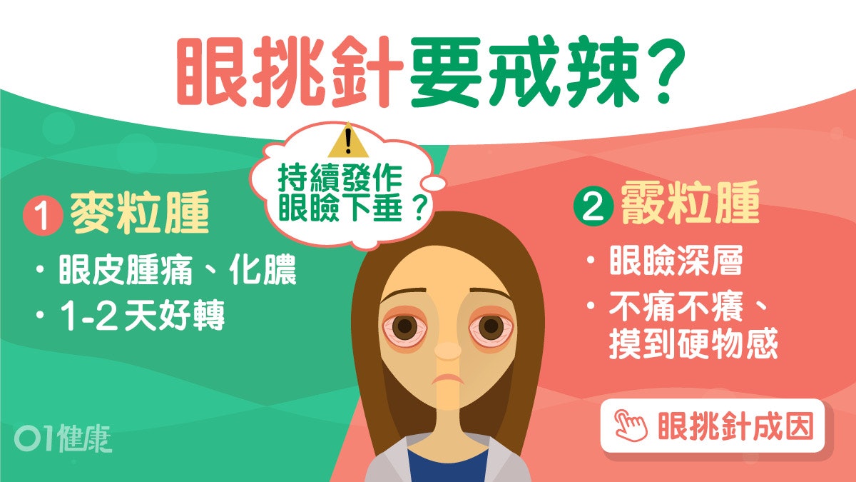 眼瘡|迪麗熱巴生眼挑針!睡眠足忌揉眼防蜂窩性組織炎戒3類食物 眼瘡|迪麗熱巴生眼挑針!睡眠足忌揉眼防蜂窩性組織炎戒3類食物