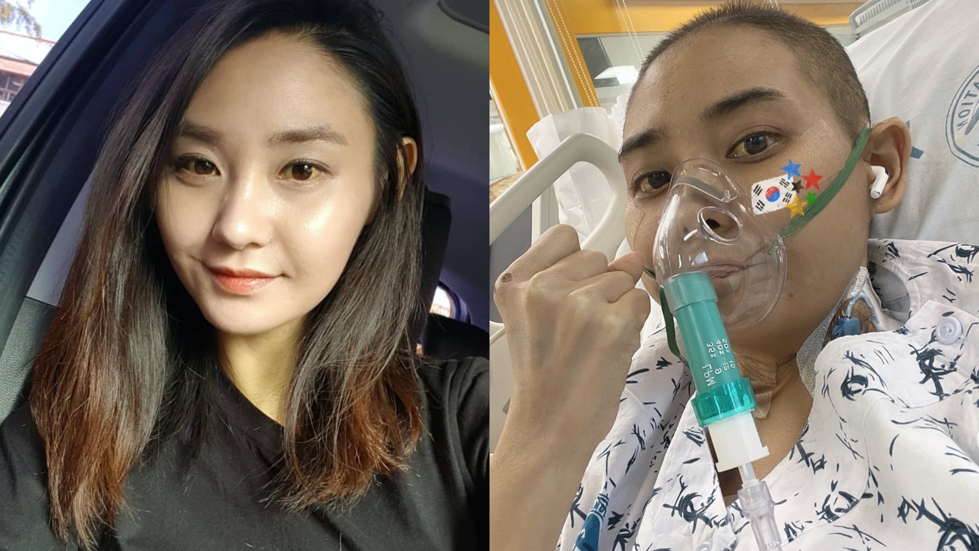 傷風感冒隨時攞你命？韓女星重感冒引發罕見疾病　苦撐一年現曙光