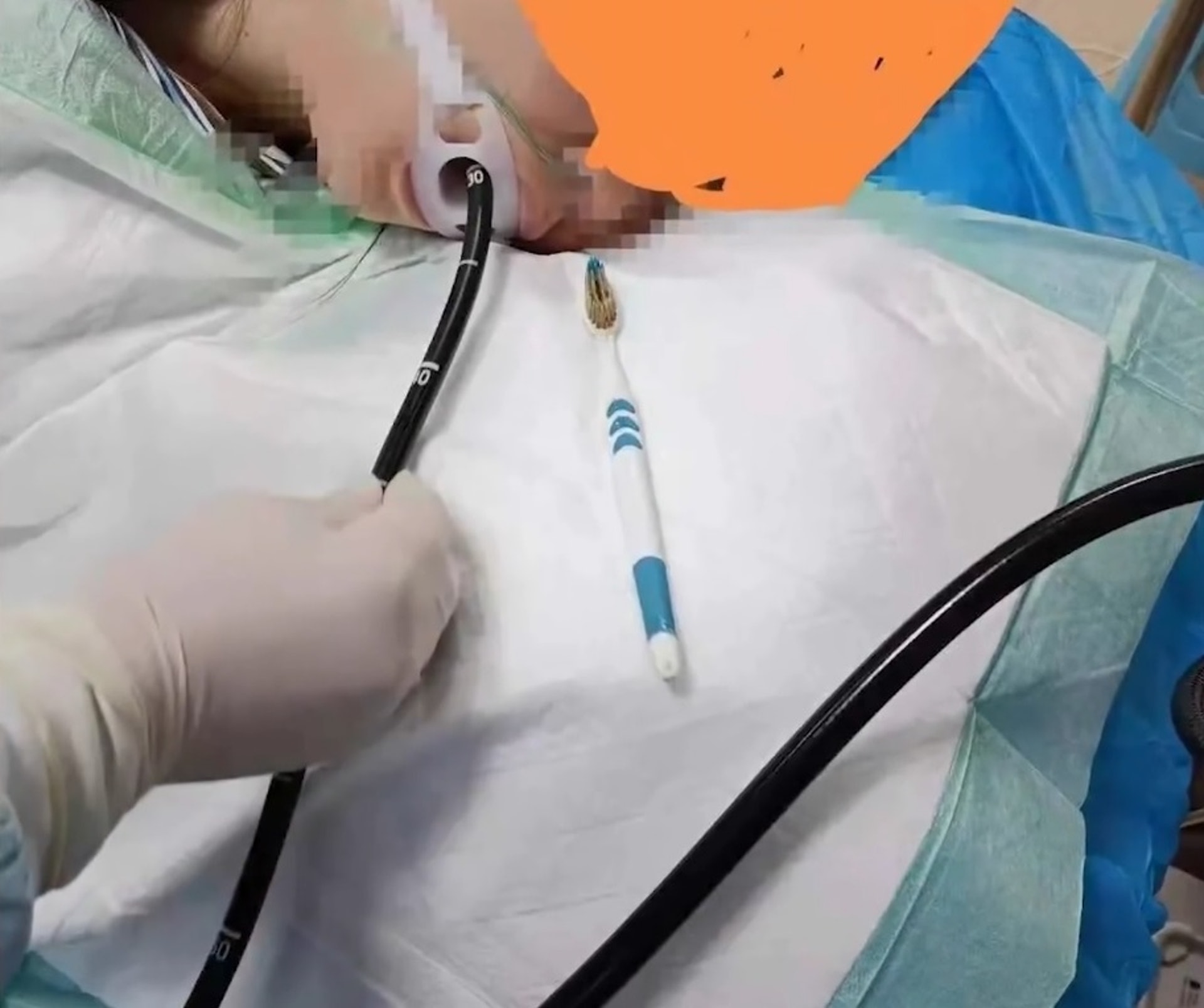 爛gag好危險 江蘇人妻刷牙聽老公笑話狂笑誤吞厘米牙刷落肚 爛gag好危險 江蘇人妻刷牙聽老公笑話狂笑誤吞厘米牙刷落肚