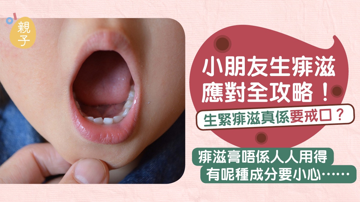 生痱滋三大成因　戒口改善飲食有幫助　有一類小朋友更易生痱滋