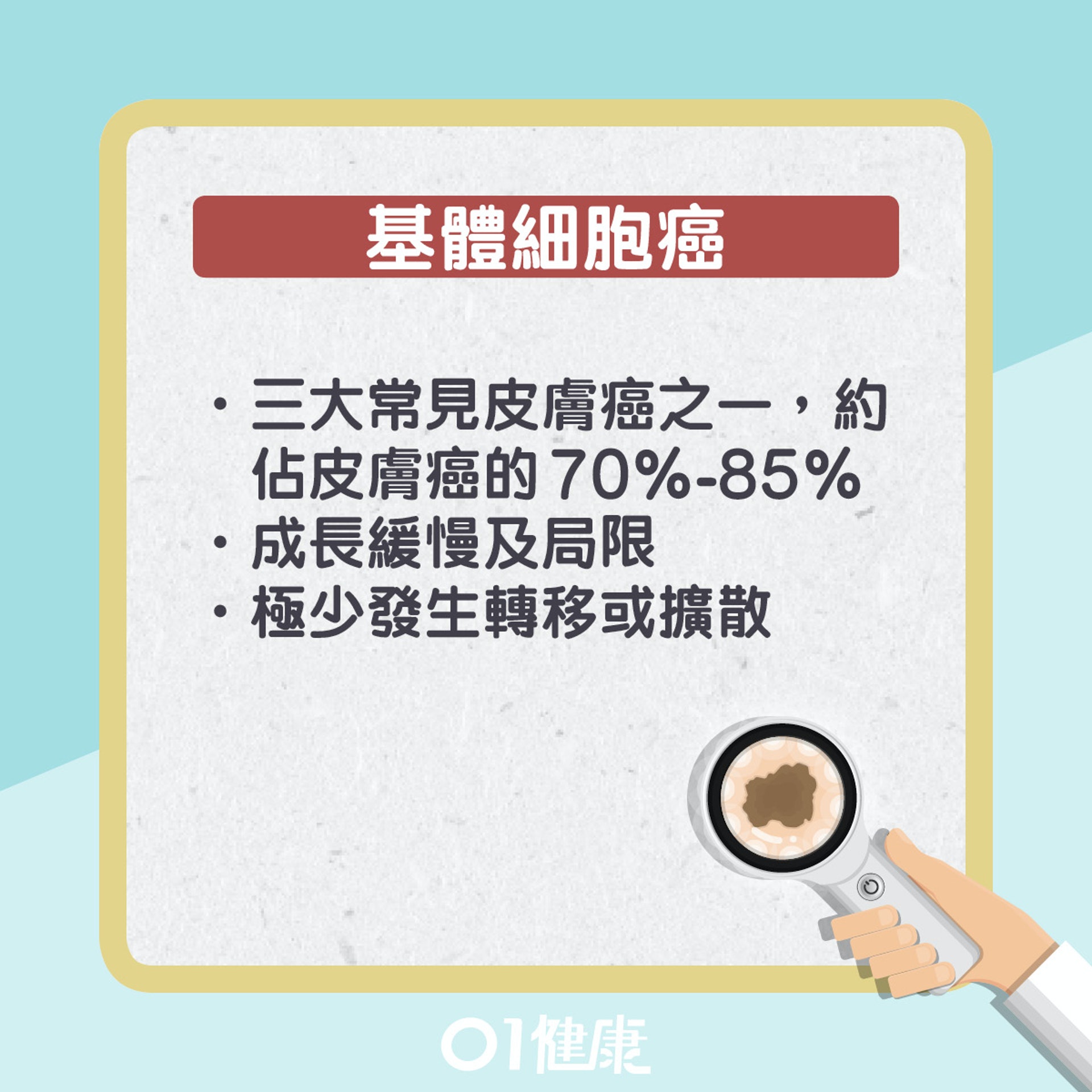 基體細胞癌其實是甚麼?(01製圖) 基體細胞癌其實是甚麼?(01製圖)
