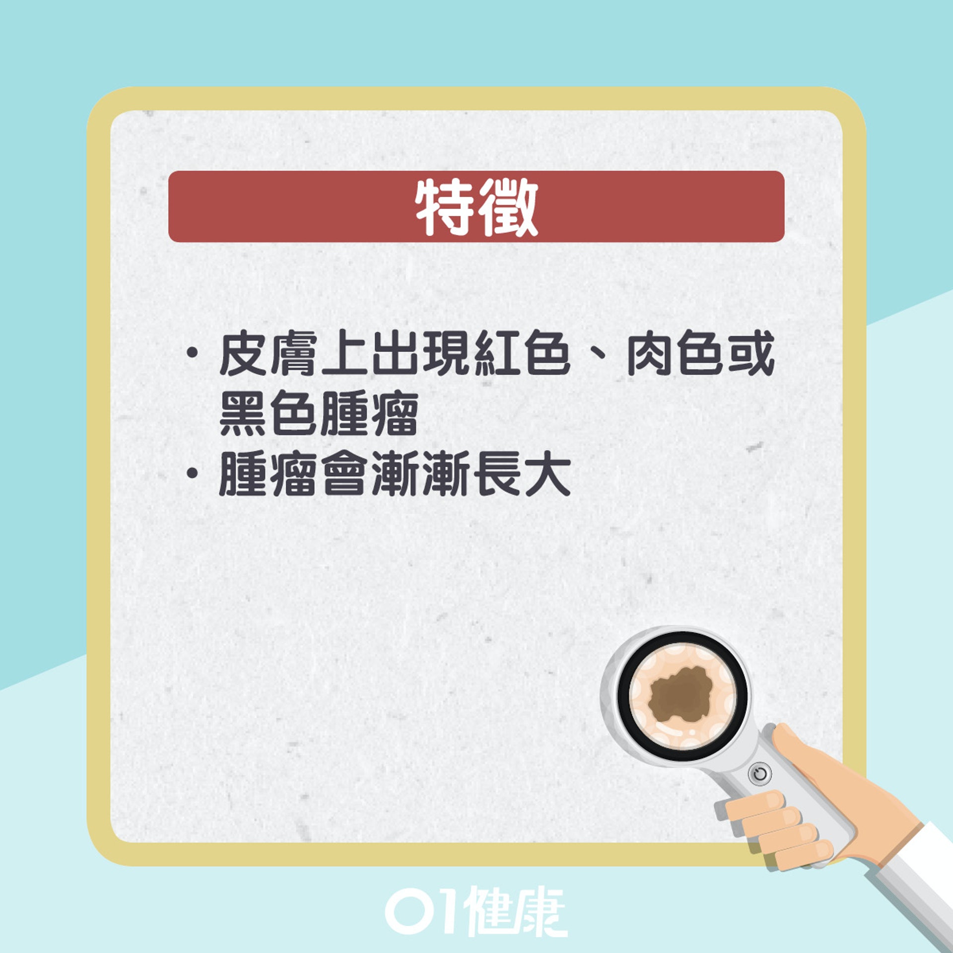 基體細胞癌其實是甚麼?(01製圖) 基體細胞癌其實是甚麼?(01製圖)