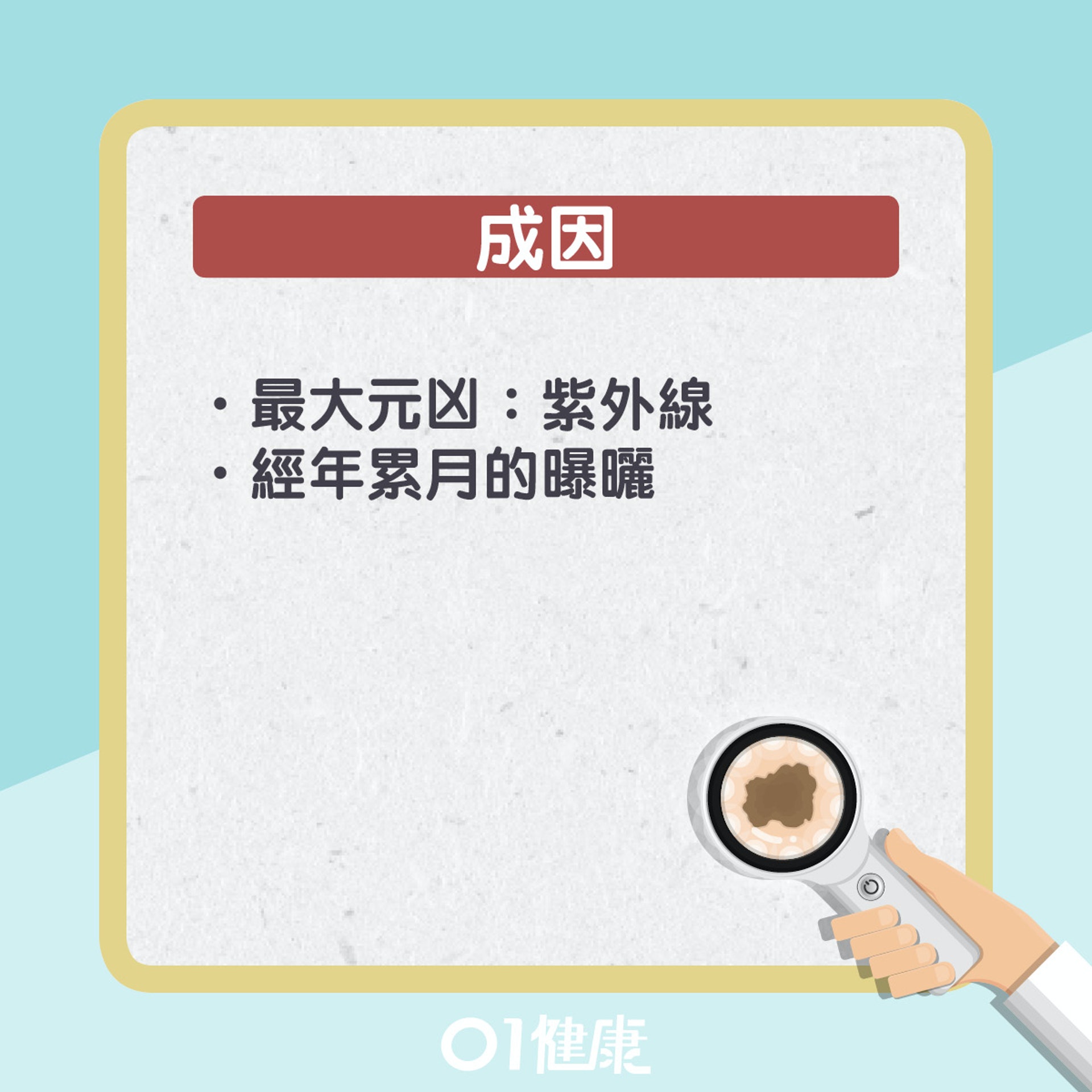 基體細胞癌其實是甚麼?(01製圖) 基體細胞癌其實是甚麼?(01製圖)