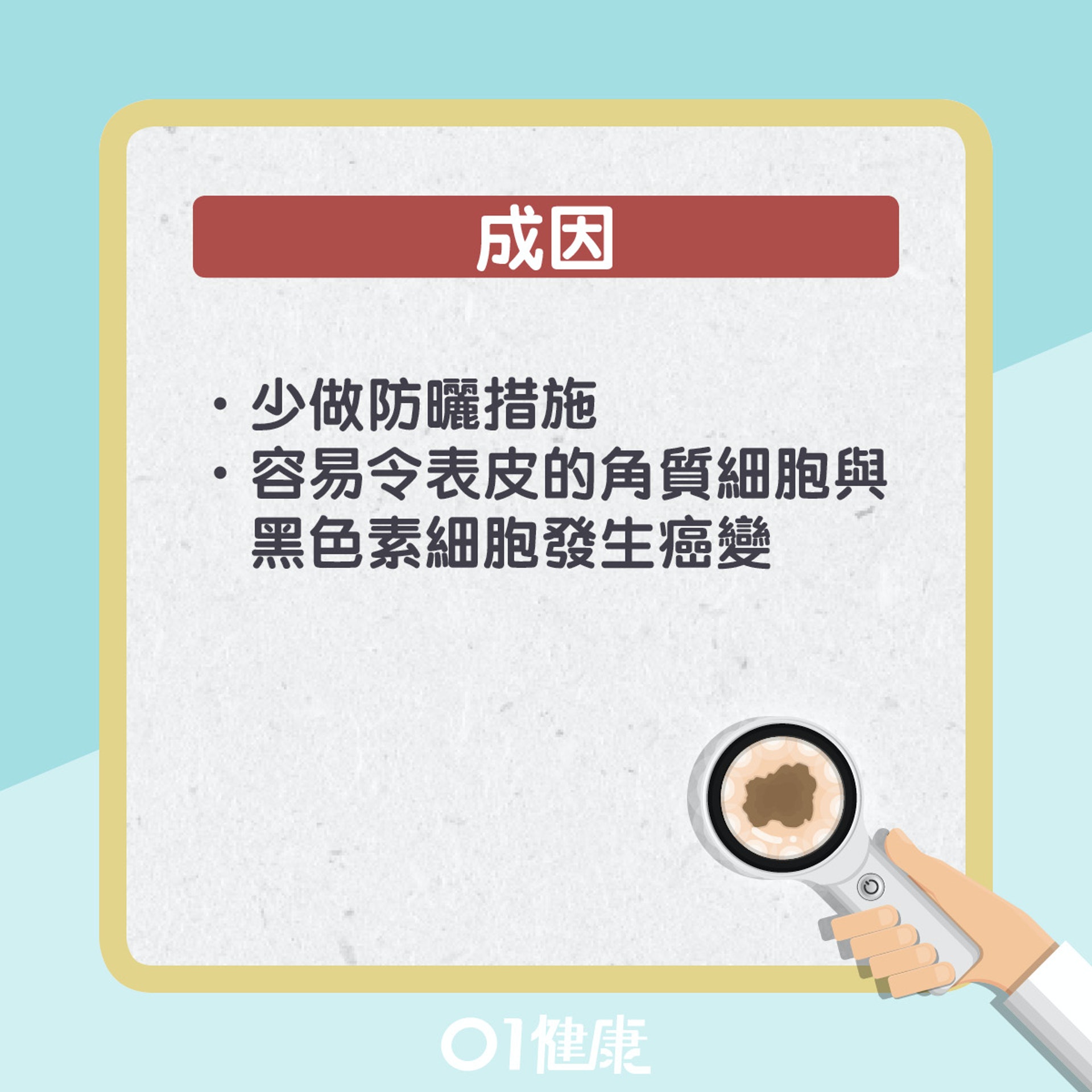 基體細胞癌其實是甚麼?(01製圖) 基體細胞癌其實是甚麼?(01製圖)