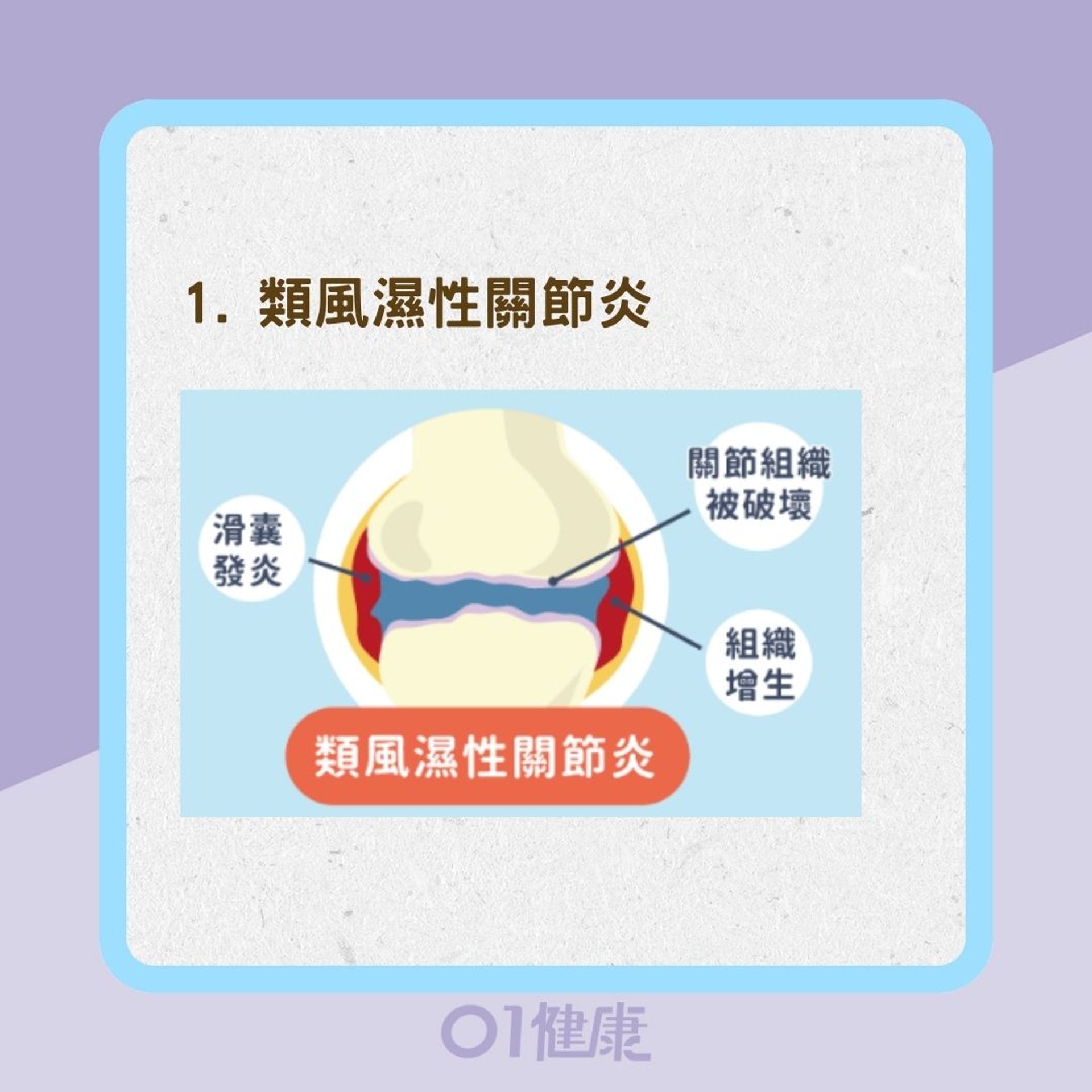 4種關節炎發生原因及症狀(Heho健康授權使用/01製圖) 4種關節炎發生原因及症狀(Heho健康授權使用/01製圖)