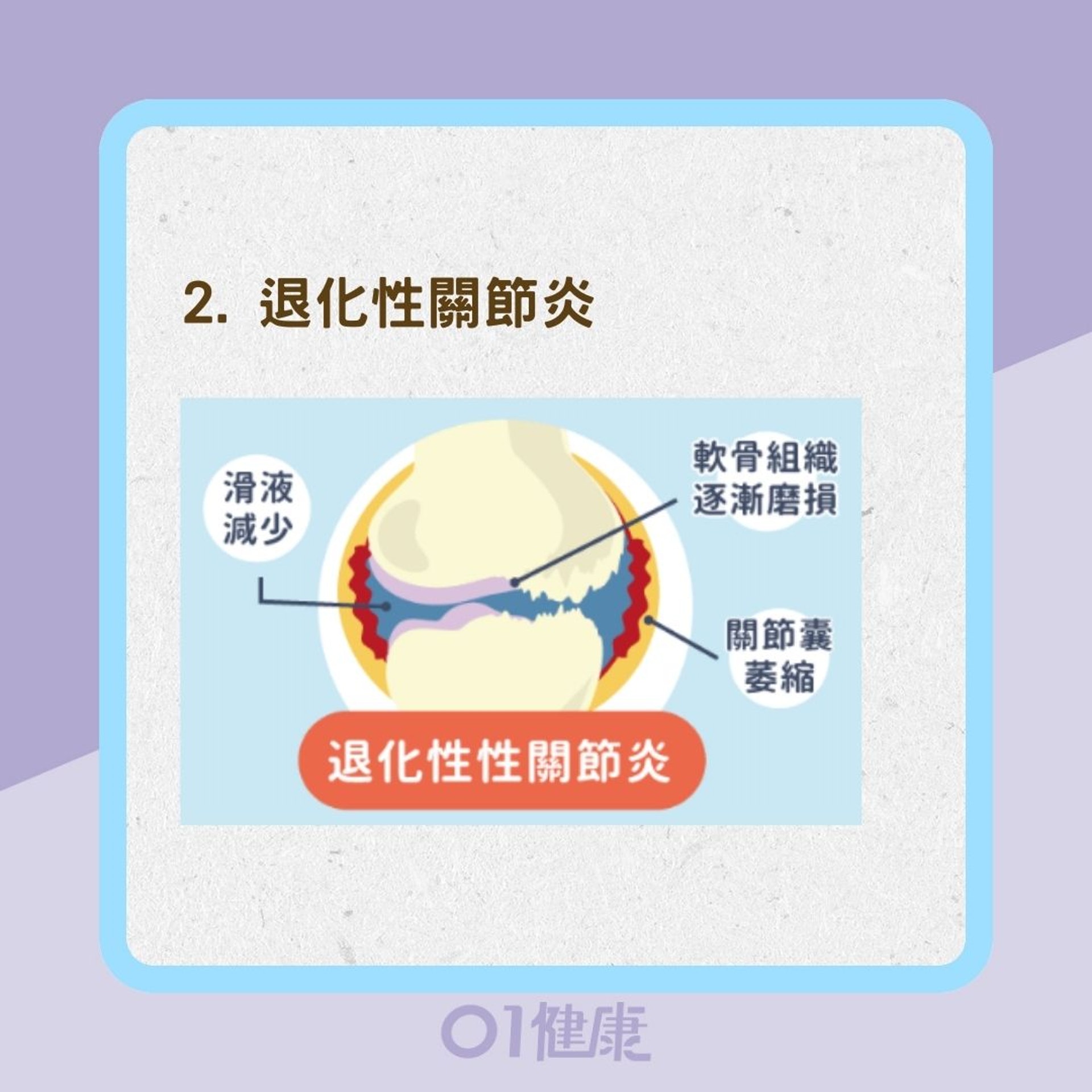 4種關節炎發生原因及症狀(Heho健康授權使用/01製圖) 4種關節炎發生原因及症狀(Heho健康授權使用/01製圖)