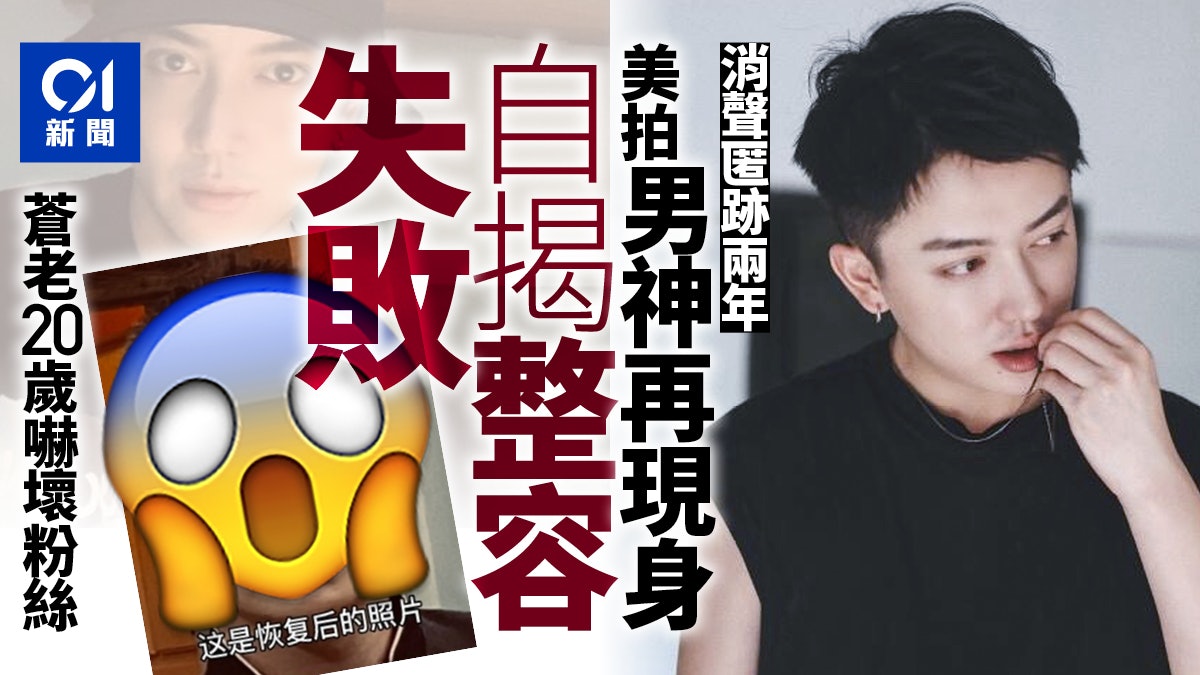美拍男神失蹤兩年終現身自揭整容失敗蒼老歲變大叔嚇壞粉絲 美拍男神失蹤兩年終現身自揭整容失敗蒼老歲變大叔嚇壞粉絲