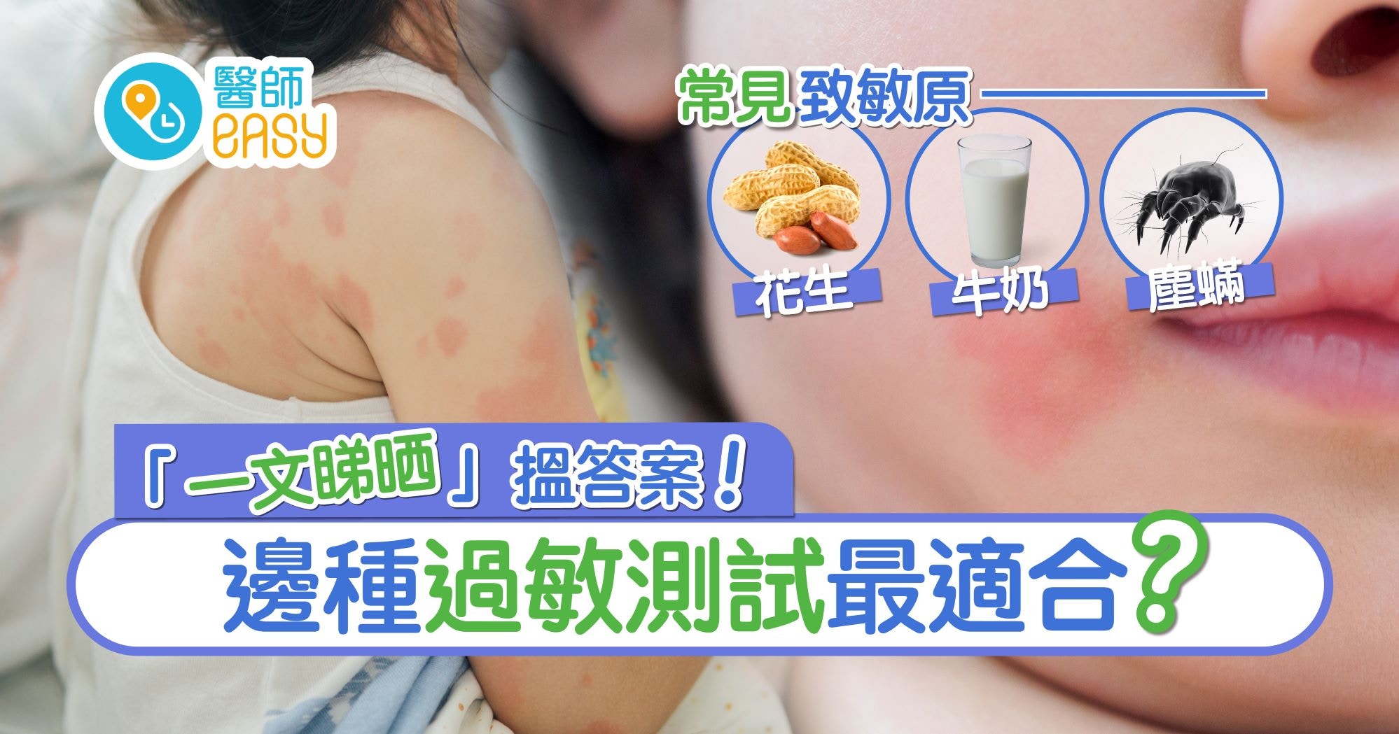 邊種過敏測試最適合？ 「一文睇晒」搵答案