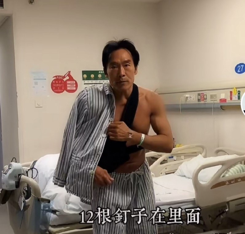 郑浩南在去年年初因为旧病复发做了手术。（影片截图）