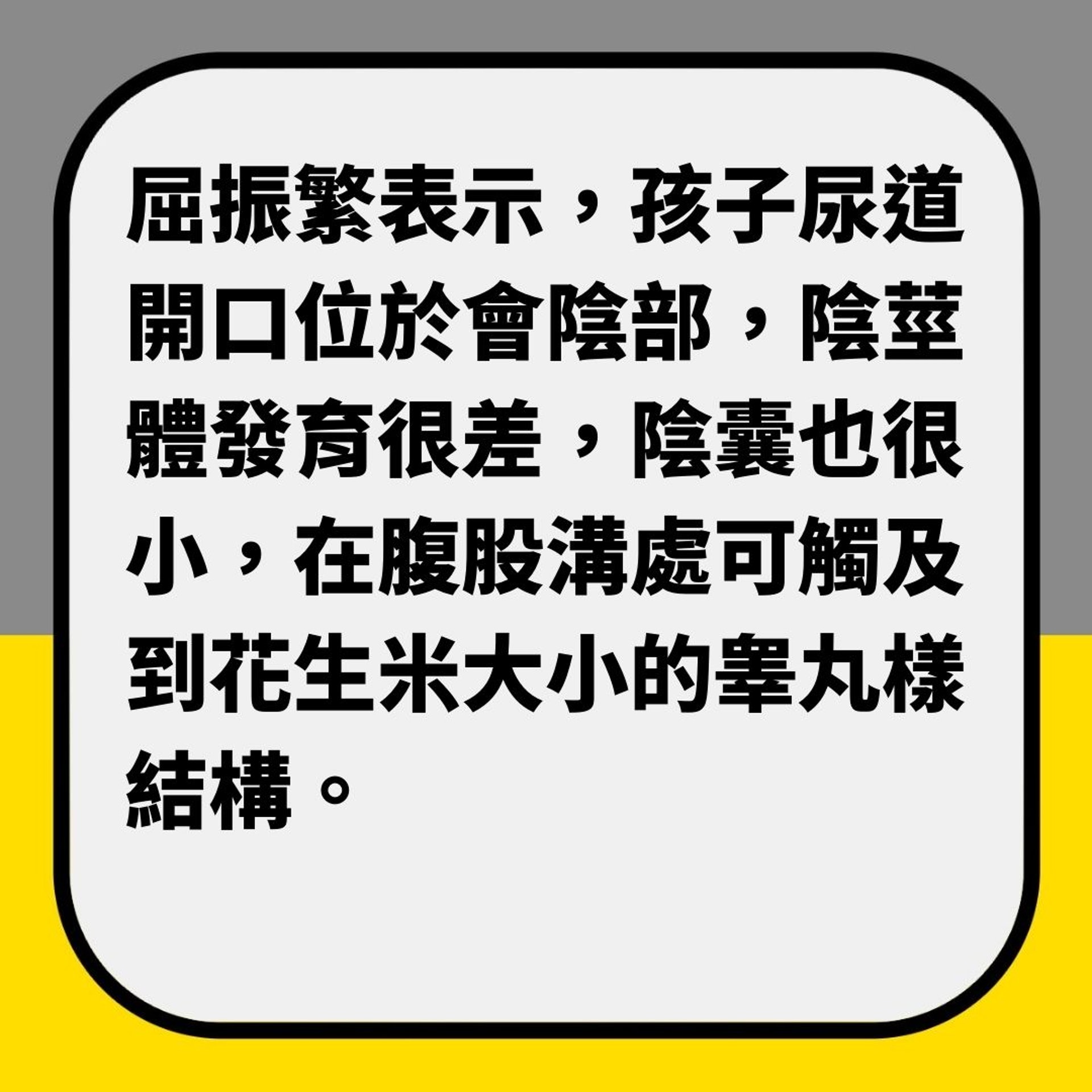 養女兒7年「驚覺是兒子」 原來患嚴重隱睾症(01製圖) 養女兒7年「驚覺是兒子」 原來患嚴重隱睾症(01製圖)