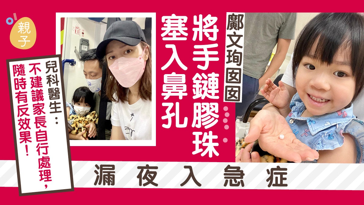 鄺文珣囡囡將膠珠塞入鼻孔急入醫院 醫生教一招自行取出但有風險 鄺文珣囡囡將膠珠塞入鼻孔急入醫院 醫生教一招自行取出但有風險