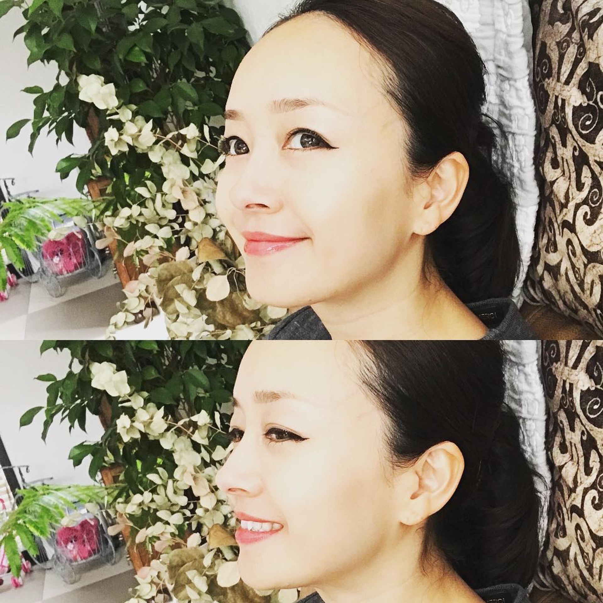 從側面看樋口明日嘉脫髮問題一樣明顯。(asuka__higuchi@ig) 從側面看樋口明日嘉脫髮問題一樣明顯。(asuka__higuchi@ig)