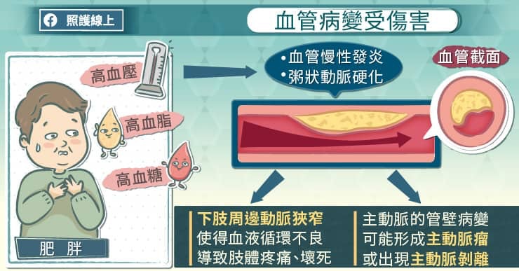 血管病變受傷害（照護線上授權使用）