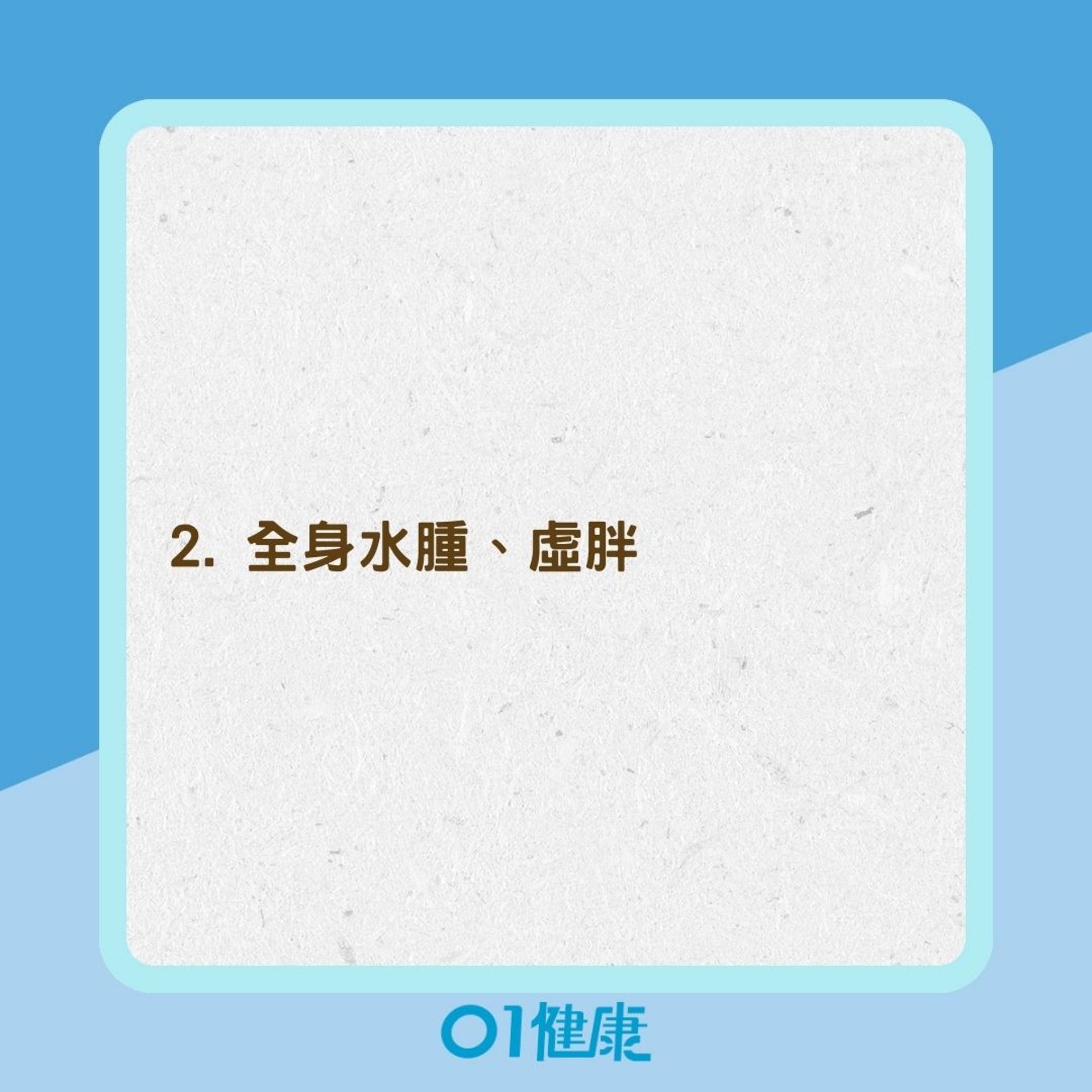 甲狀腺低下常見症狀(01製圖) 甲狀腺低下常見症狀(01製圖)