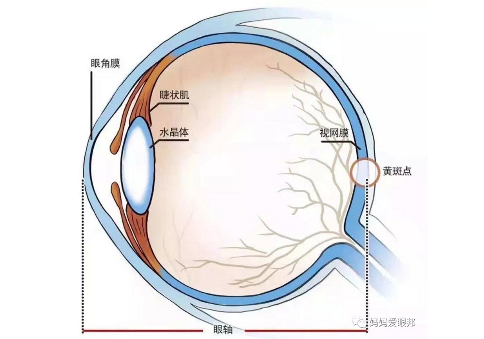 兒童近視的原因之一是眼軸過長或角膜弧度太彎,另一原因是睫狀肌過度使用無法放鬆。(圖片:知乎) 兒童近視的原因之一是眼軸過長或角膜弧度太彎,另一原因是睫狀肌過度使用無法放鬆。(圖片:知乎)