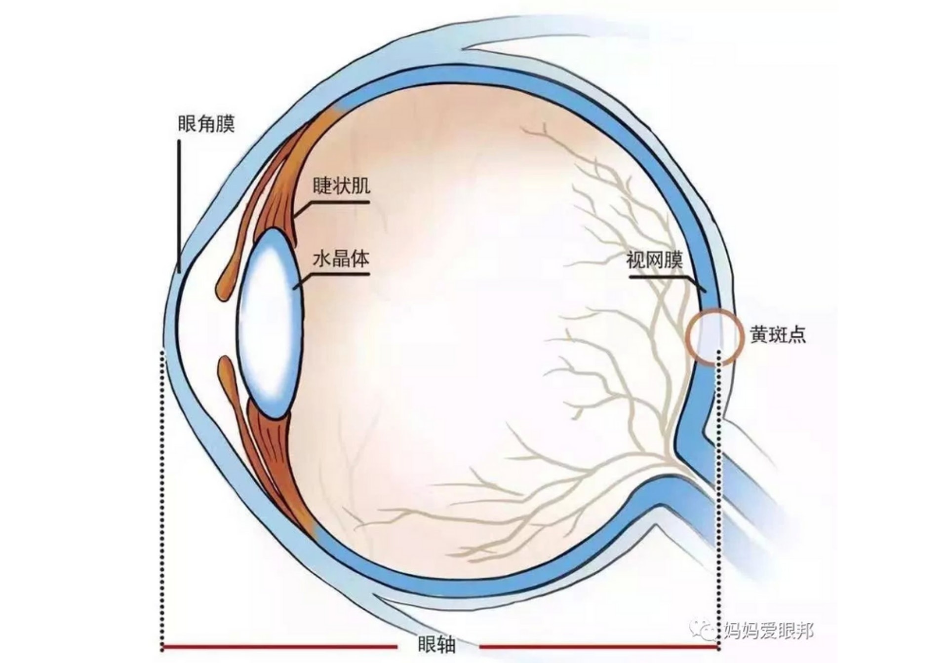 兒童近視的原因之一是眼軸過長或角膜弧度太彎，另一原因是睫狀肌過度使用無法放鬆。(圖片：知乎)