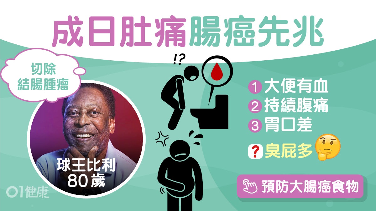 大腸癌|球王比利切除結腸腫瘤仍留醫 瘜肉變大腸癌5先兆多臭屁? 大腸癌|球王比利切除結腸腫瘤仍留醫 瘜肉變大腸癌5先兆多臭屁?