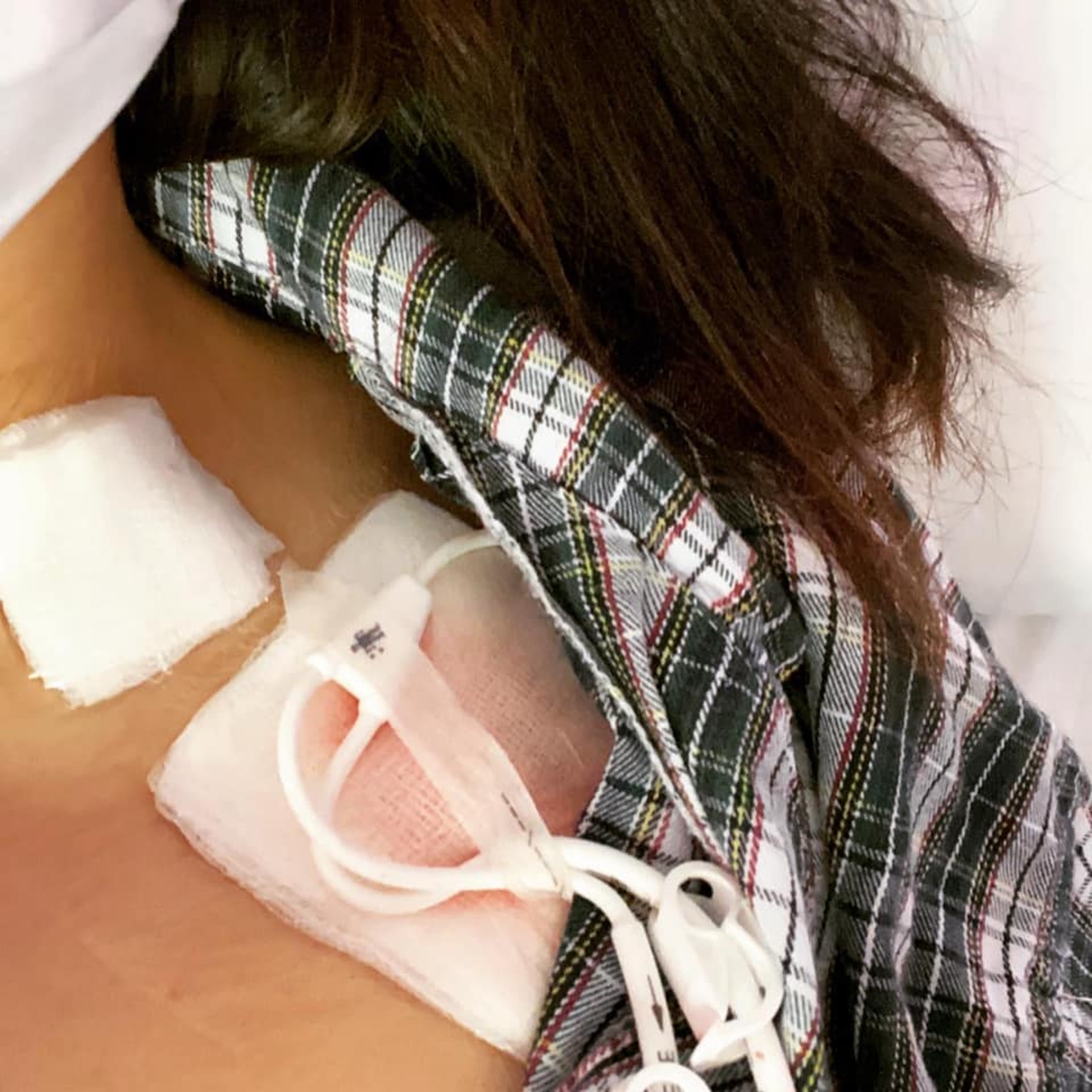 劉韵琳分享自己身在醫院接受治療的照片，令人心酸。（Facebook/Harriet Liu）