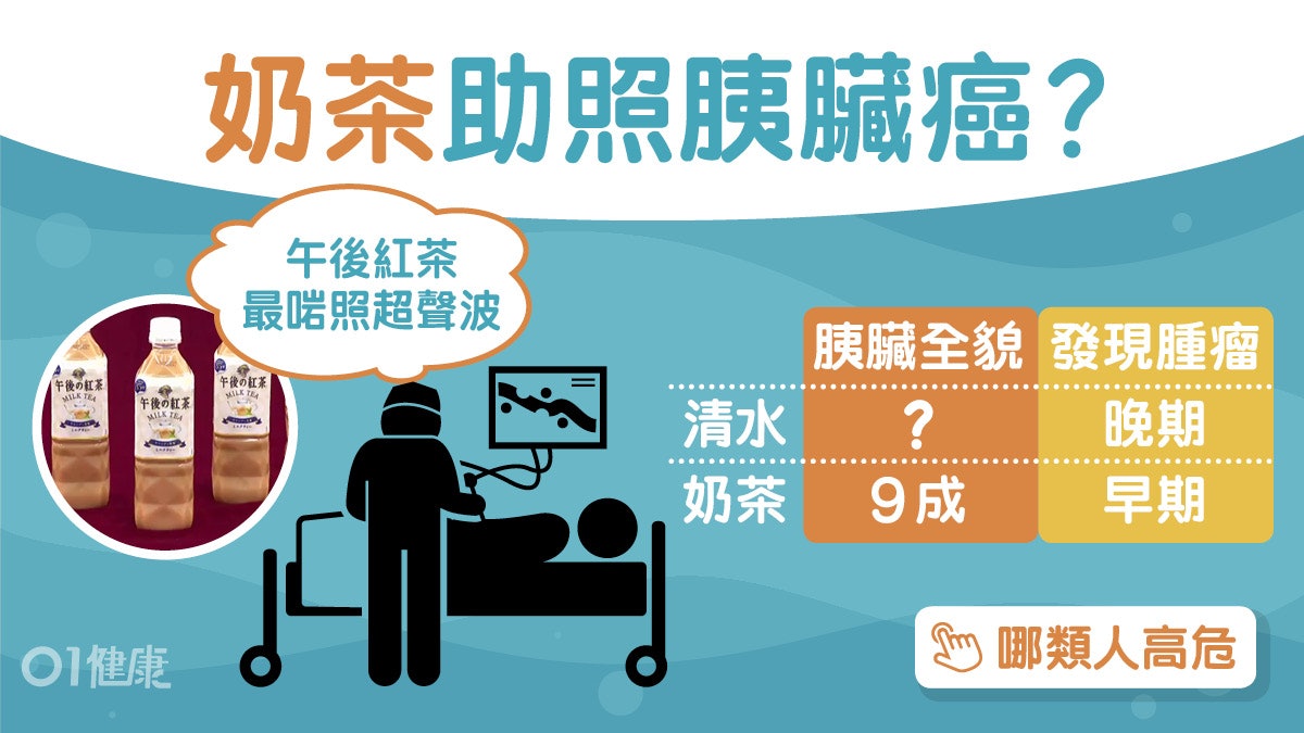 胰臟癌|午後紅茶助發現早期胰臟癌!存活率増20%糖尿病5類人高危 胰臟癌|午後紅茶助發現早期胰臟癌!存活率増20%糖尿病5類人高危