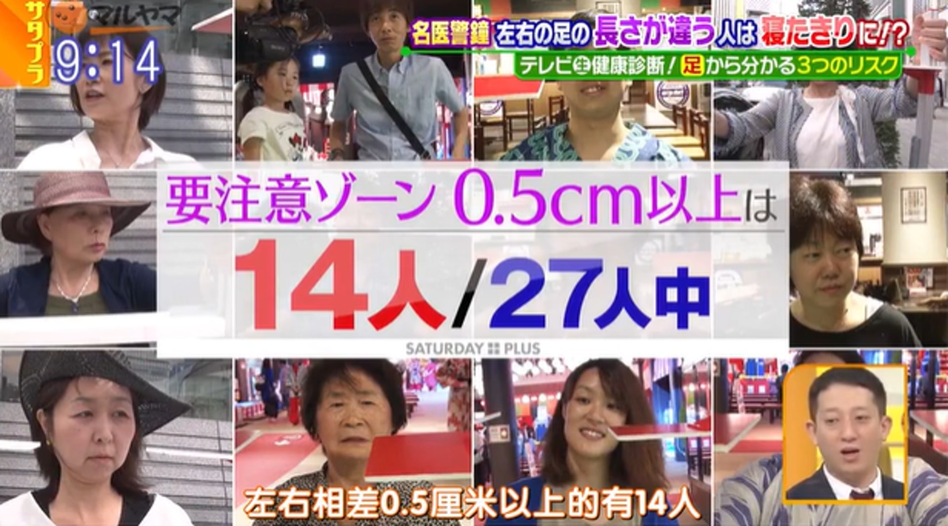 長短腳(Leg Length Discrepancy)是指患者雙腳長短不一的偏差問題。(《Saturday Plus》節目截圖) 長短腳(Leg Length Discrepancy)是指患者雙腳長短不一的偏差問題。(《Saturday Plus》節目截圖)