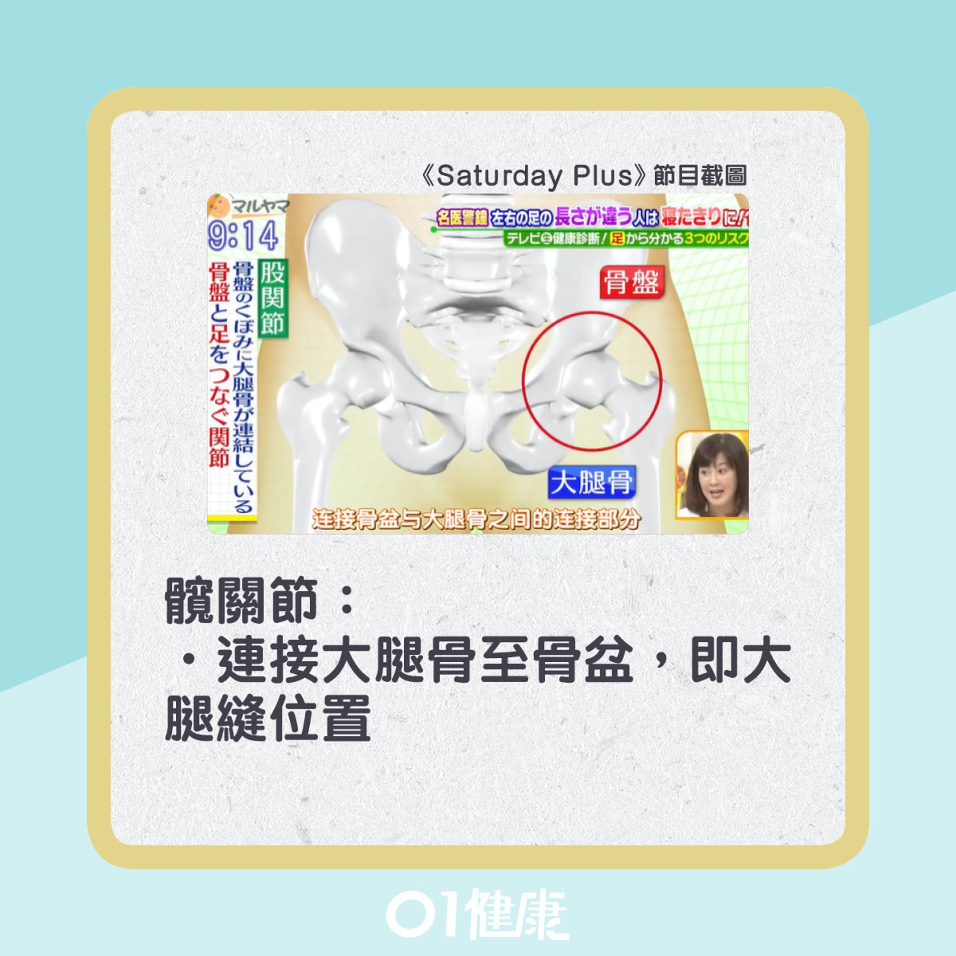 髖關節炎成因。(01製圖) 髖關節炎成因。(01製圖)