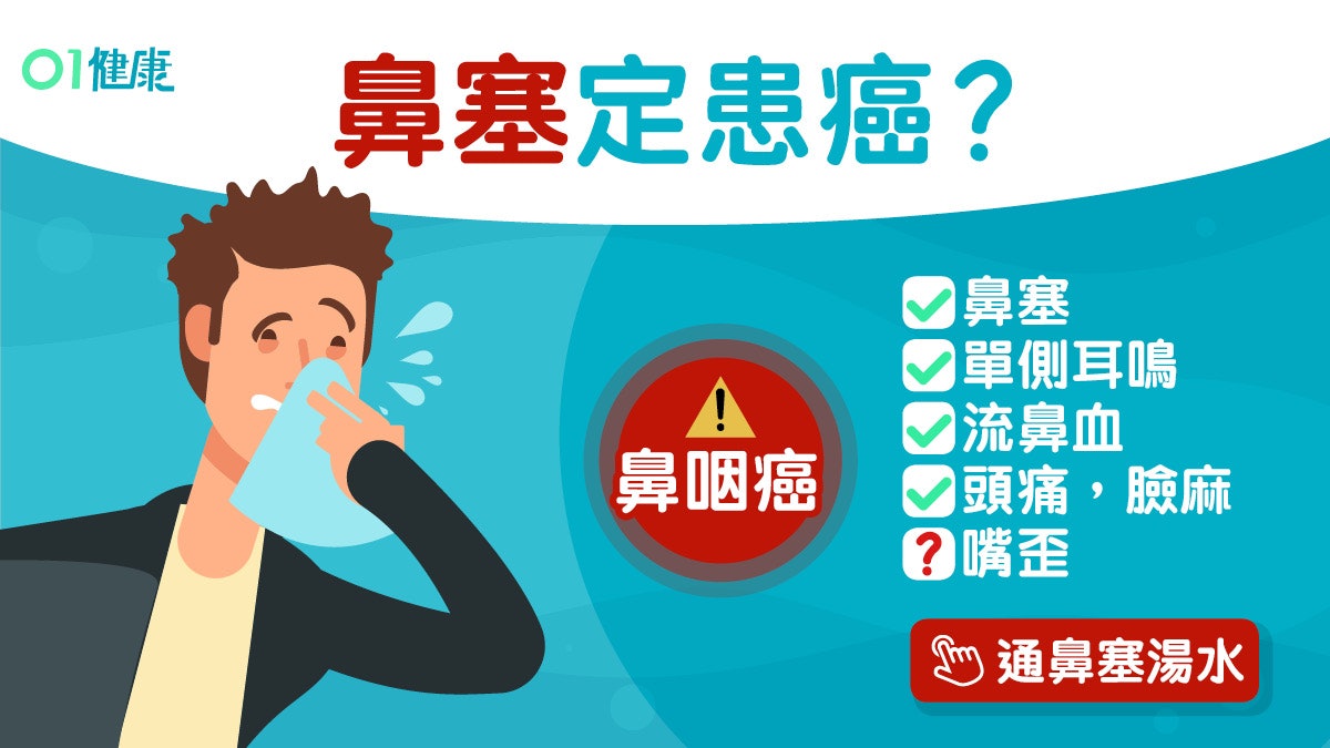 鼻咽癌|鼻塞伴耳鳴流鼻血5症狀或鼻咽癌 醫生3招預防炒菜有關? 鼻咽癌|鼻塞伴耳鳴流鼻血5症狀或鼻咽癌 醫生3招預防炒菜有關?