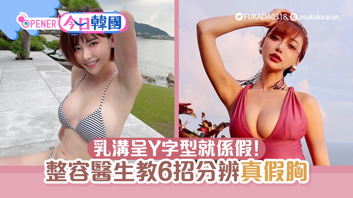 整容醫生教你憑肉眼分辨真假胸人造胸乳溝呈y型 跑步即見真章 整容醫生教你憑肉眼分辨真假胸人造胸乳溝呈y型 跑步即見真章