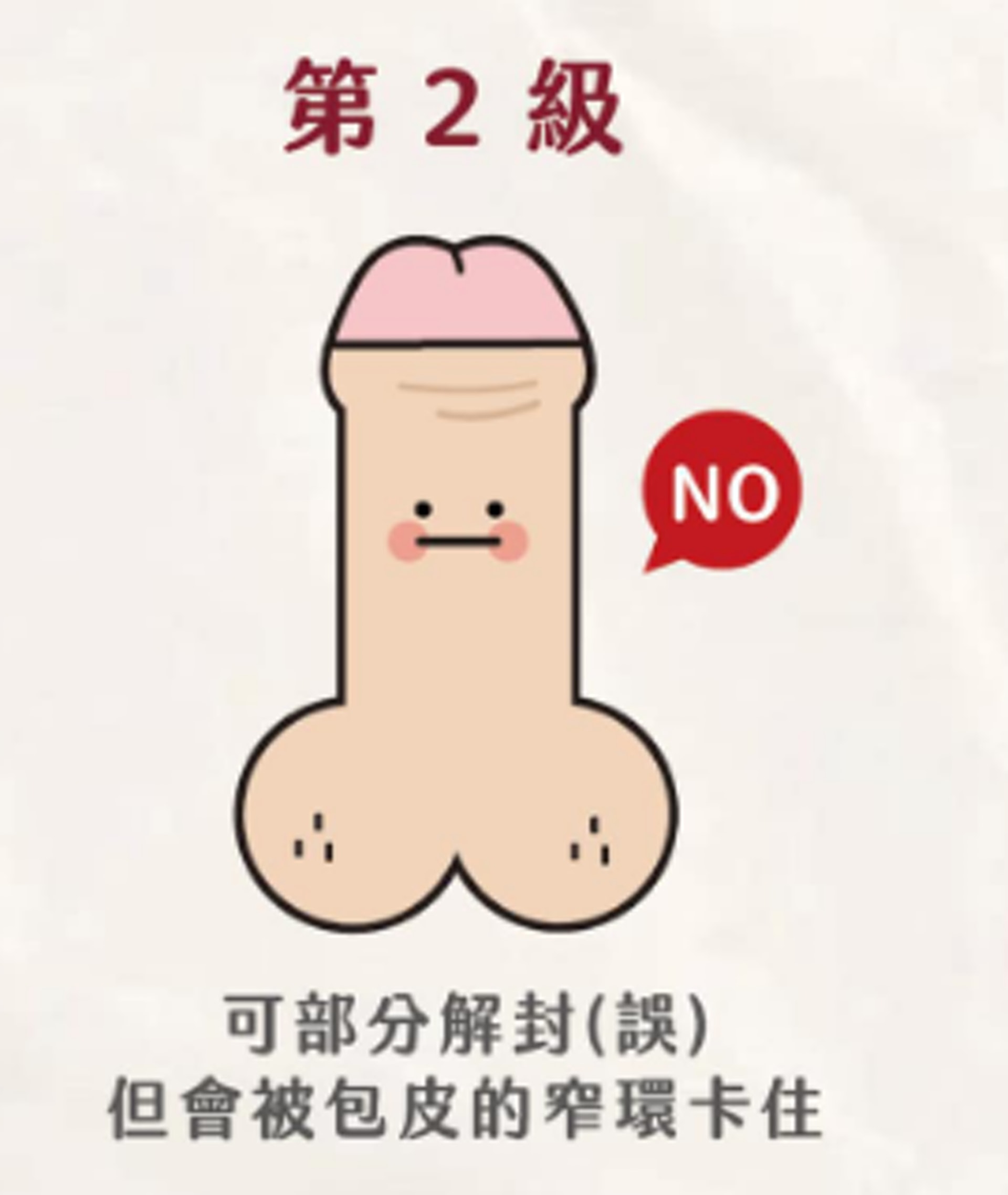若屬於2~5級情況,就屬於包莖過長,建議尋求專業醫生協助。(FB@鳥科學先生-泌尿科顧芳瑜醫師) 若屬於2~5級情況,就屬於包莖過長,建議尋求專業醫生協助。(FB@鳥科學先生-泌尿科顧芳瑜醫師)