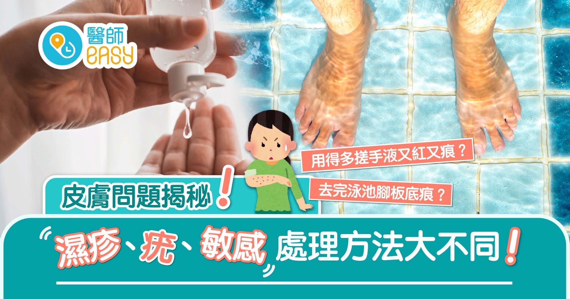 皮膚問題｜常用酒精消毒易痕癢濕疹 公眾浴室易惹疣 亂挑會擴散