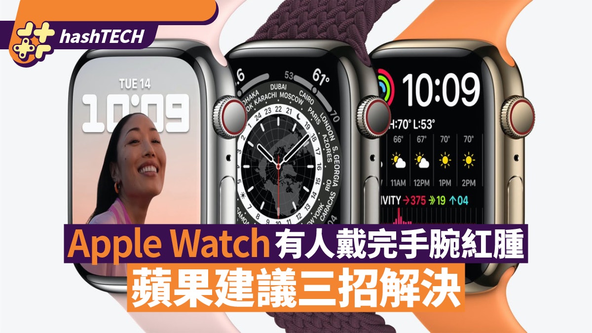 Apple Watch用家注意!有人戴完手腕刺痛紅腫 蘋果建議三招改善 Apple Watch用家注意!有人戴完手腕刺痛紅腫 蘋果建議三招改善