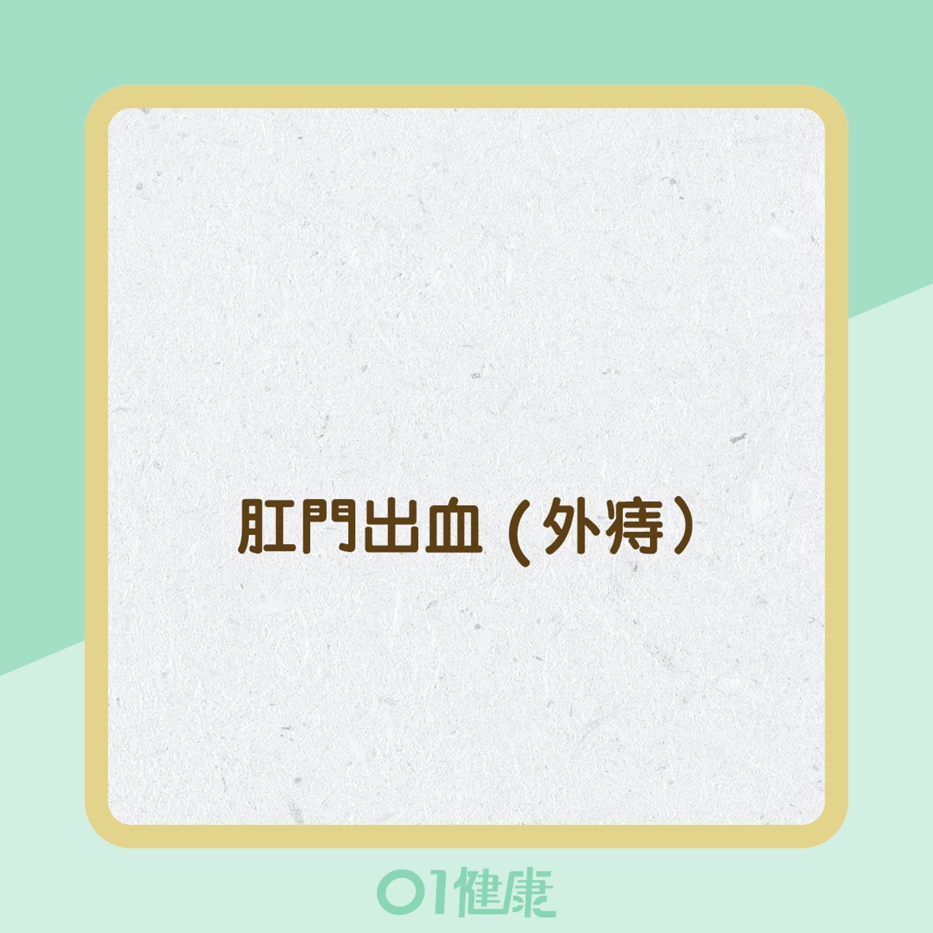 痔瘡的症狀 (01製圖)