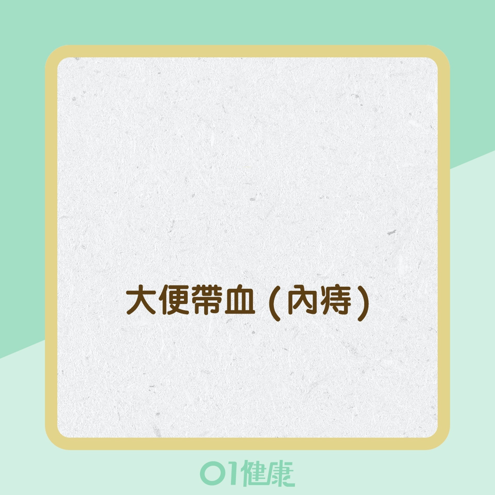 痔瘡的症狀 (01製圖) 痔瘡的症狀 (01製圖)