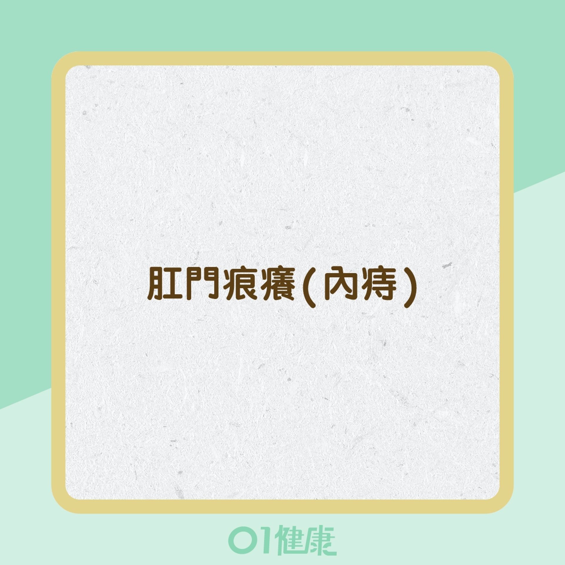 痔瘡的症狀 (01製圖) 痔瘡的症狀 (01製圖)