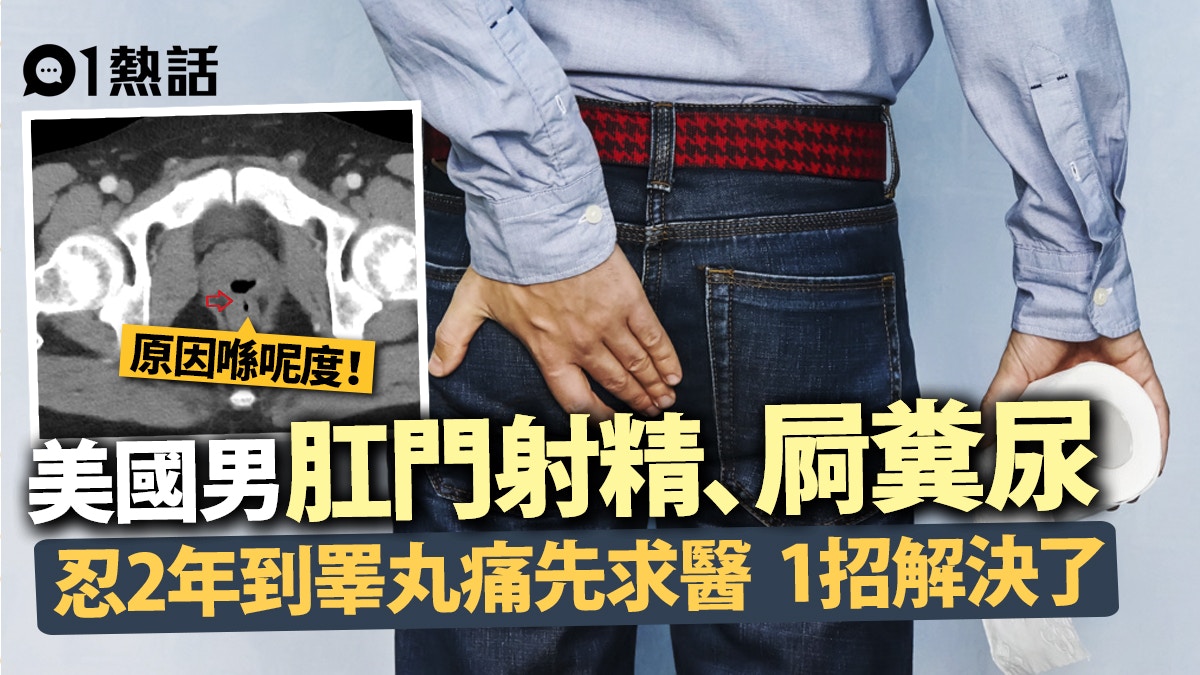 男肛門 