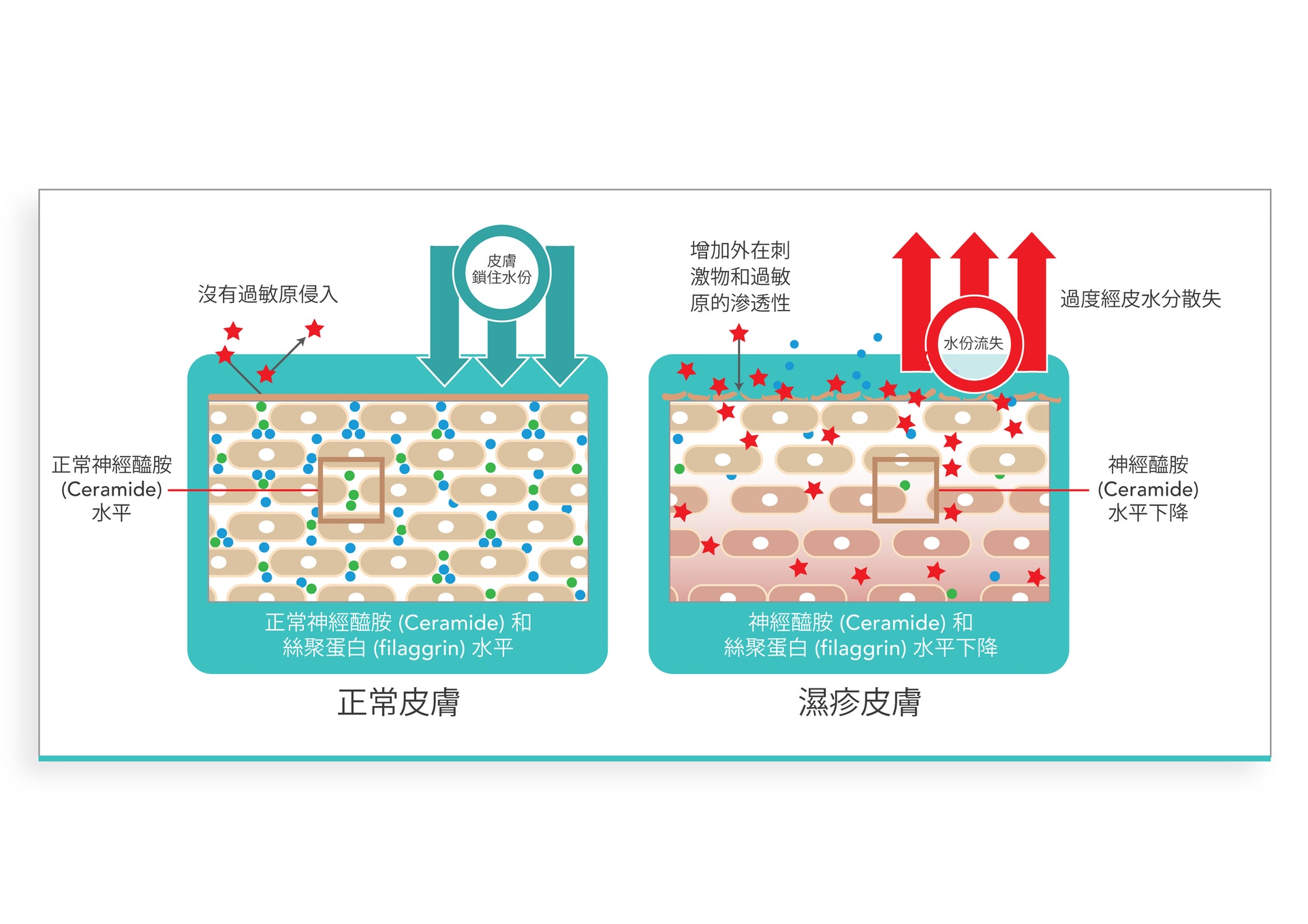 長期使用含SLS 及SLES的沐浴露會令皮膚過度去脂，加劇皮膚屏障的受損。（圖片：Suu Balm）