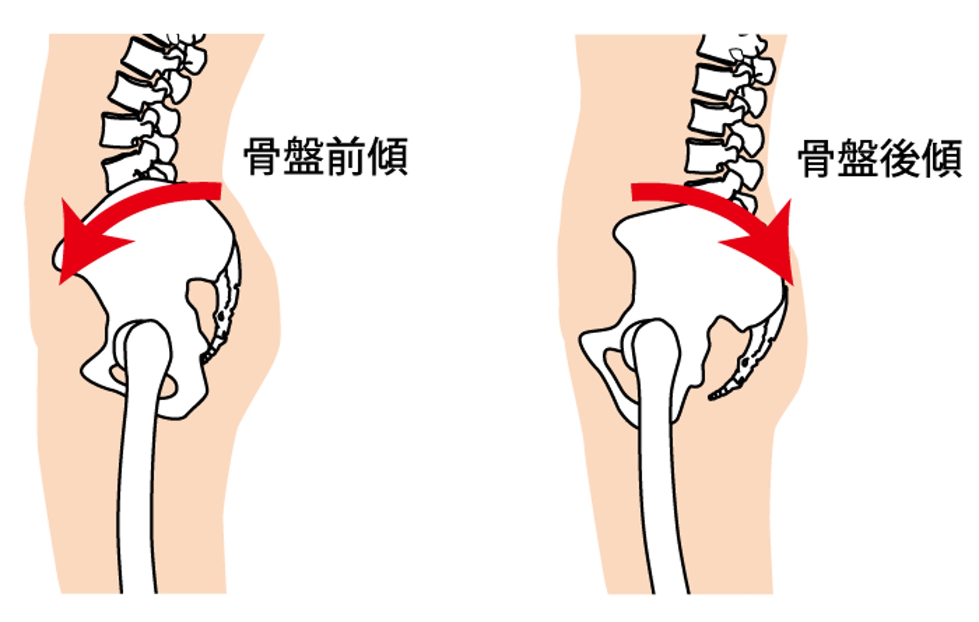 長期久坐加上姿勢不正確，容易導致骨盤前傾或後傾等問題。（圖片：physioapproach）