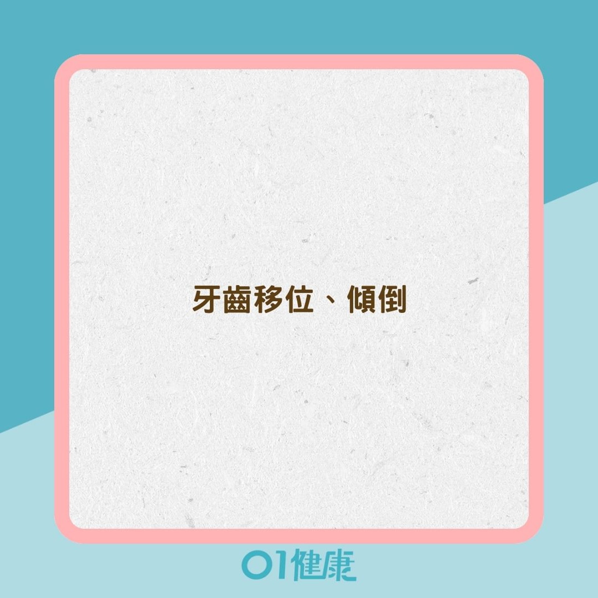 缺牙不處理問題(01製圖) 缺牙不處理問題(01製圖)