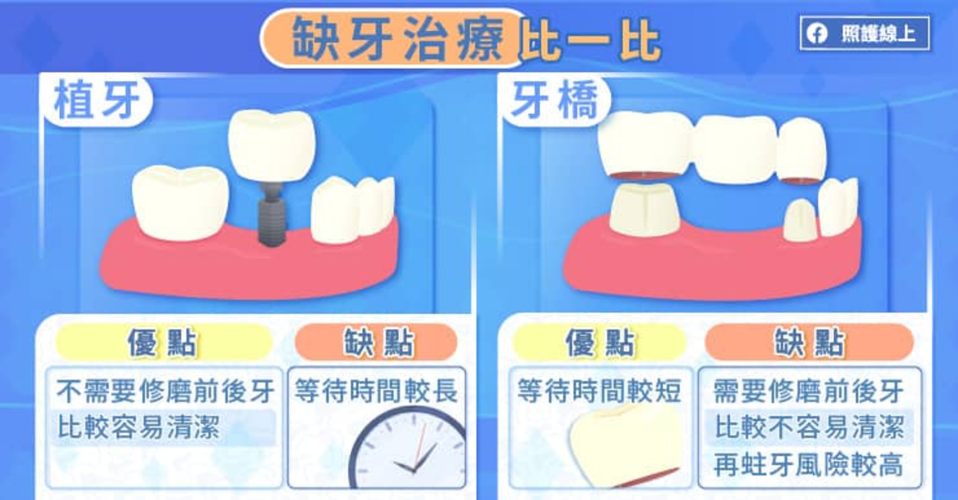 缺牙治療（照護線上授權使用）