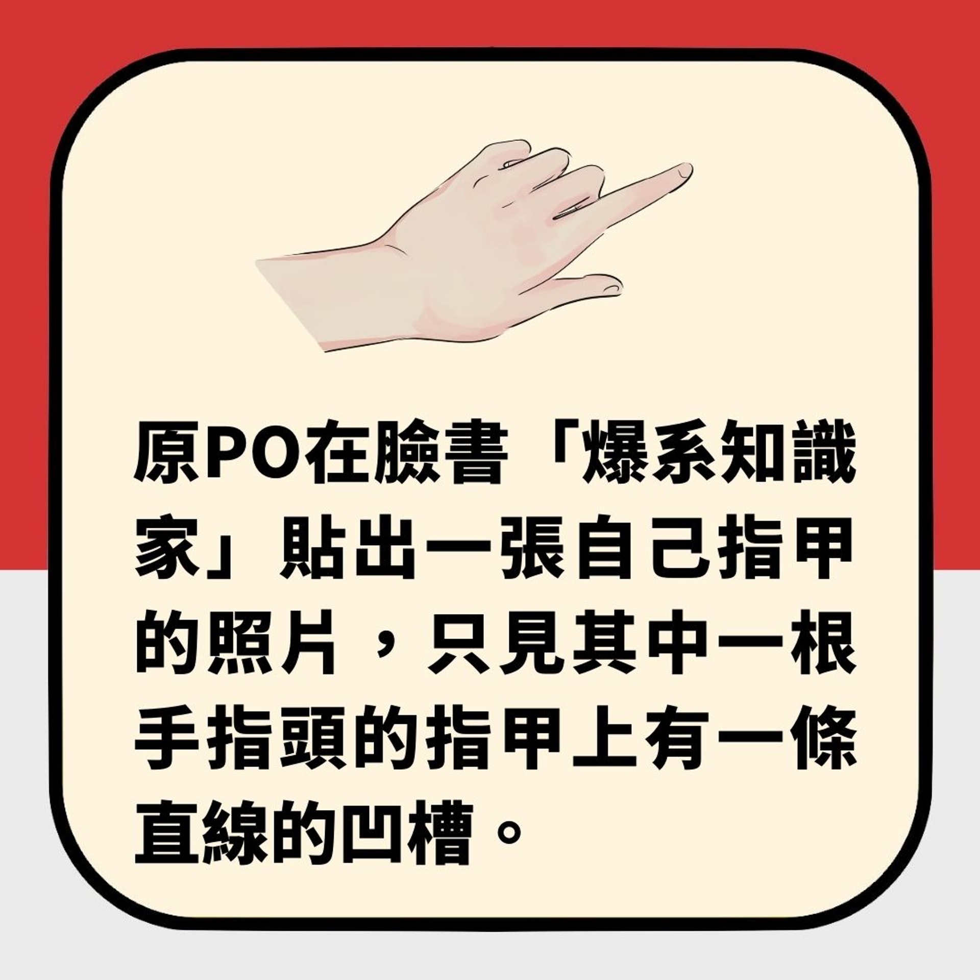女網友指甲出現垂直凹槽 過來人警告快去檢查 可能是這器官出事(01製圖) 女網友指甲出現垂直凹槽 過來人警告快去檢查 可能是這器官出事(01製圖)