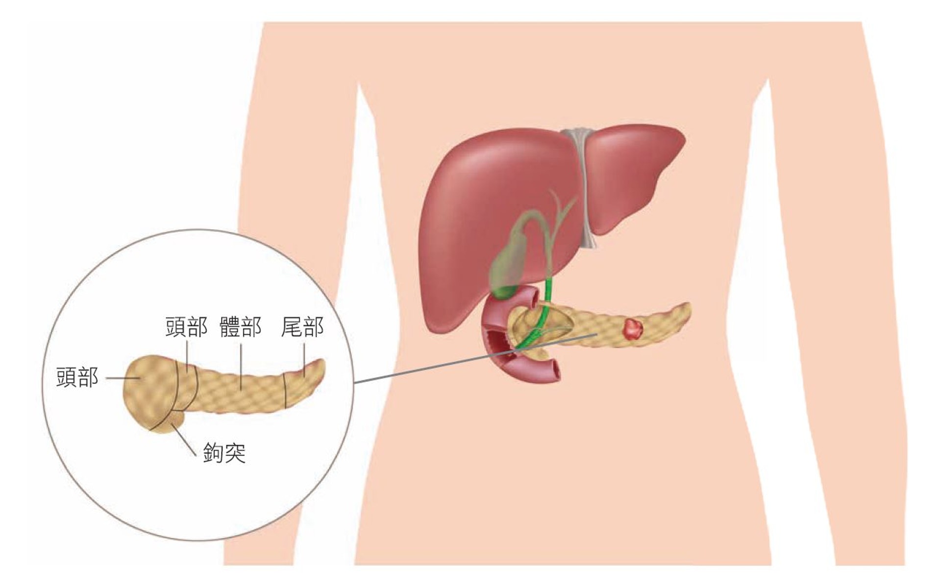 胰臟位於腹腔深處,夾在胃部、大小腸及背脊,同時連接十二指腸的器官。(圖片:永越健康管理中心) 胰臟位於腹腔深處,夾在胃部、大小腸及背脊,同時連接十二指腸的器官。(圖片:永越健康管理中心)