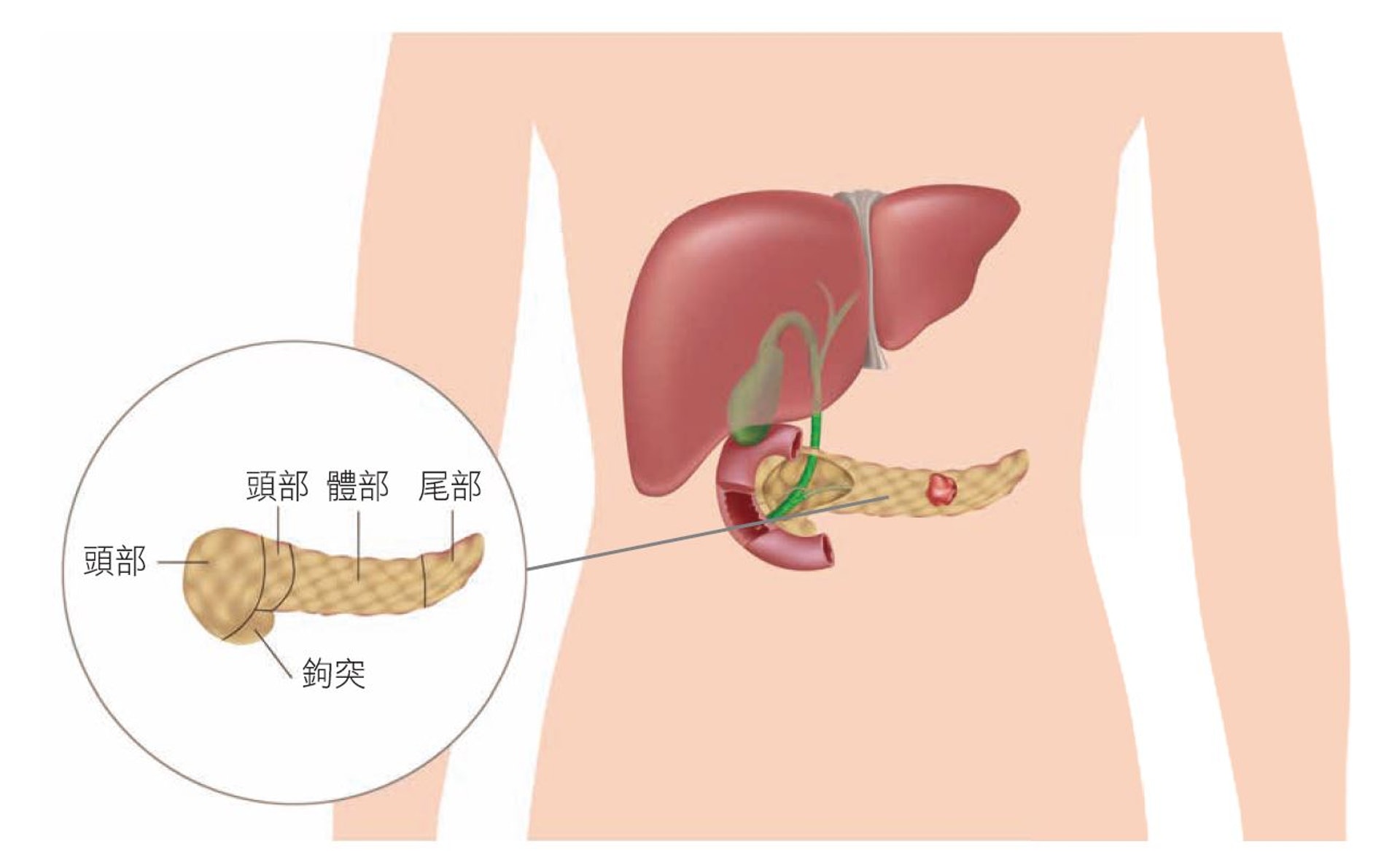 胰臟位於腹腔深處，夾在胃部、大小腸及背脊，同時連接十二指腸的器官。（圖片：永越健康管理中心）