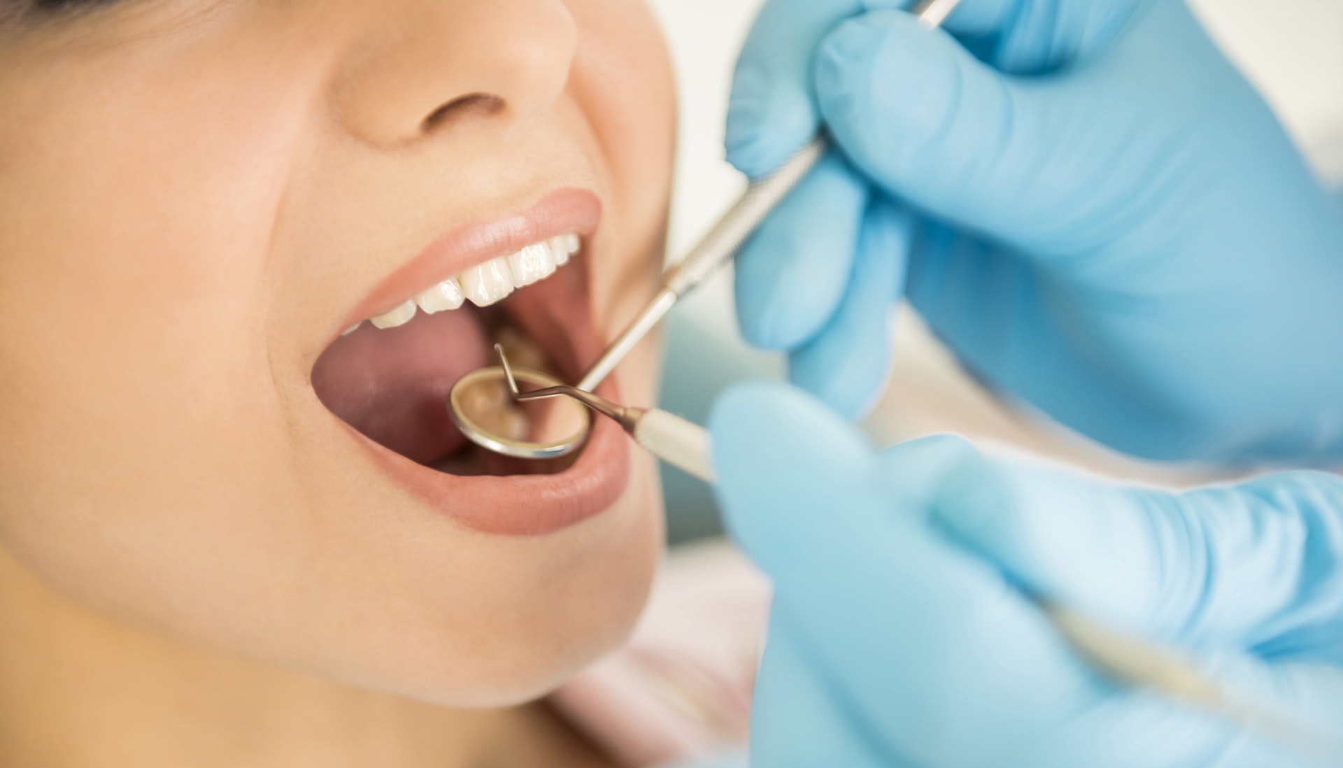 牙齒保健對一般人來說固然重要，但原來有幾類人士更應常見牙醫。（圖片：mamilove）