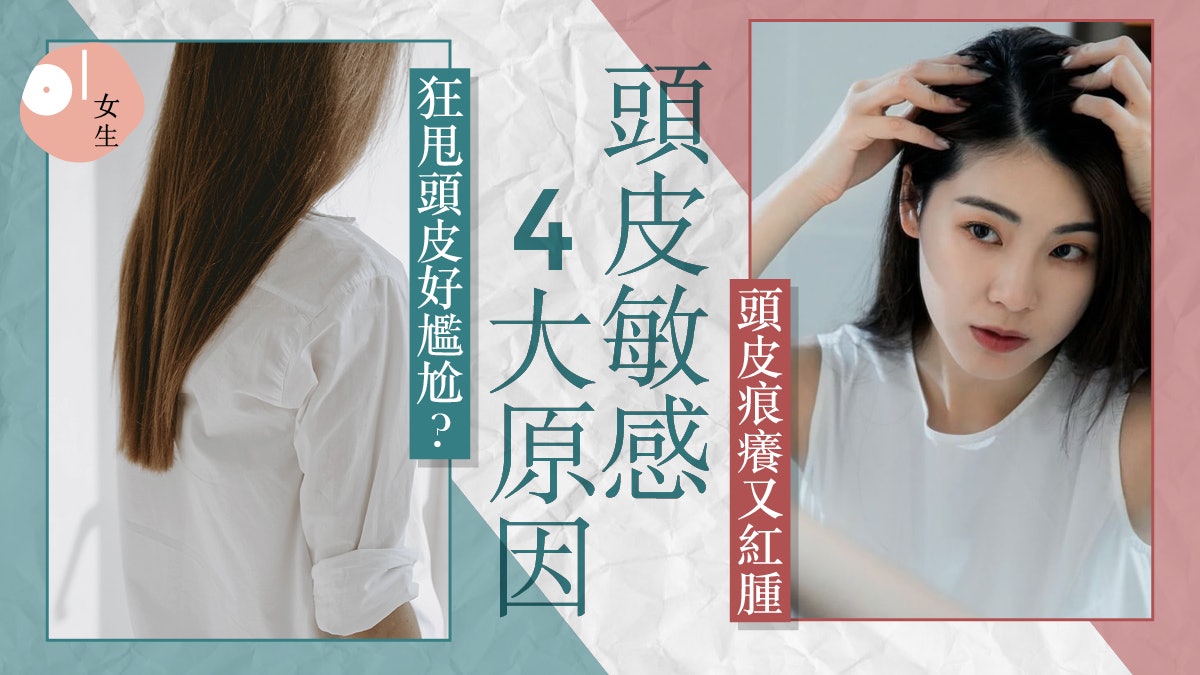 護髮|頭皮痕癢生痘痘 嚴重可致脫髮禿頭危機?頭皮敏感4大原因 護髮|頭皮痕癢生痘痘 嚴重可致脫髮禿頭危機?頭皮敏感4大原因