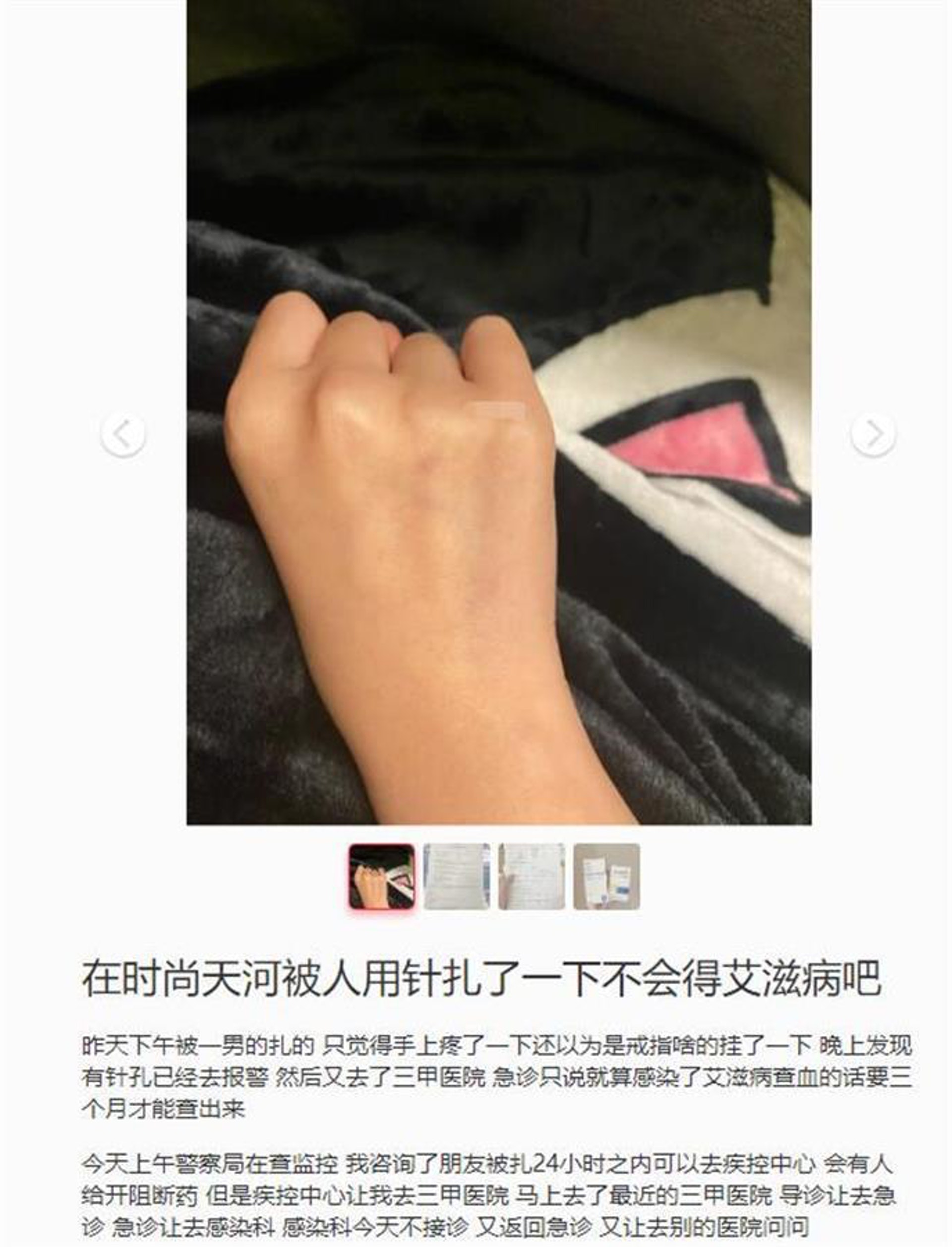 網民發博文聲稱廣州街頭被人用針扎。(微博) 網民發博文聲稱廣州街頭被人用針扎。(微博)