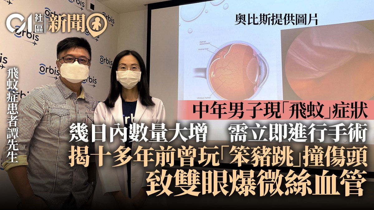 飛蚊症可致視網膜脫落 嚴重或造成永久失明 眼科醫生籲及早檢查 飛蚊症可致視網膜脫落 嚴重或造成永久失明 眼科醫生籲及早檢查