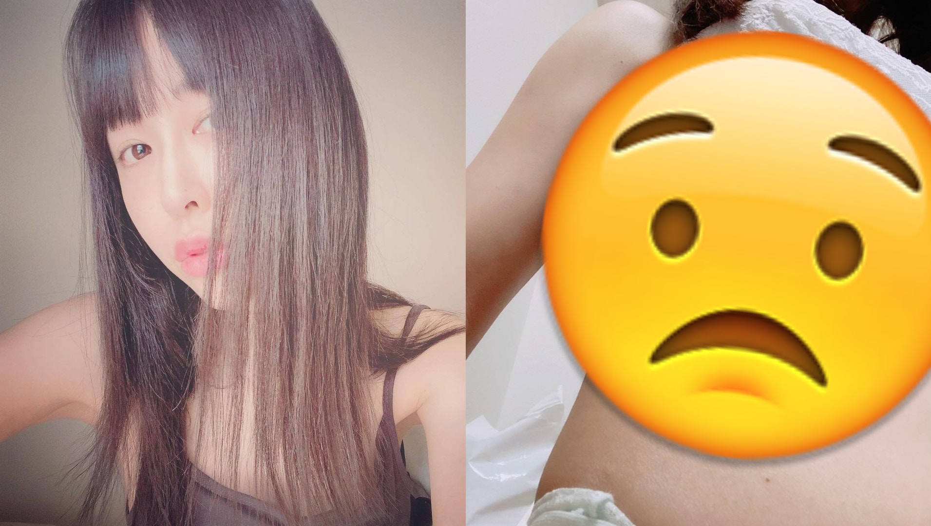 Av女優隆胸隔日被性侵 聽到下胸埋線斷裂的聲音 傷疤照片極恐怖